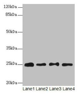 Western blot. All lanes: RPS8 antibody at 6µg/ml. Lane 1: HL60 whole cell lysate. Lane 2: THP-1 whole cell lysate. Lane 3: 293T whole cell lysate. Lane 4: Mouse liver tissue. Secondary. Goat polyclonal to rabbit IgG at 1/10000 dilution. Predicted band size: 25 kDa. Observed band size: 25 kDa