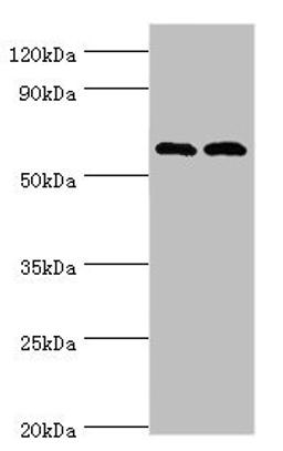Western blot. All lanes: Serine/threonine-protein kinase PAK 2 antibody at 2ug/ml. Lane 1: Jurkat whole cell lysate. Lane 2: Hela whole cell lysate. Secondary. Goat polyclonal to rabbit IgG at 1/10000 dilution. Predicted band size: 58 kDa. Observed band size: 58 kDa. 