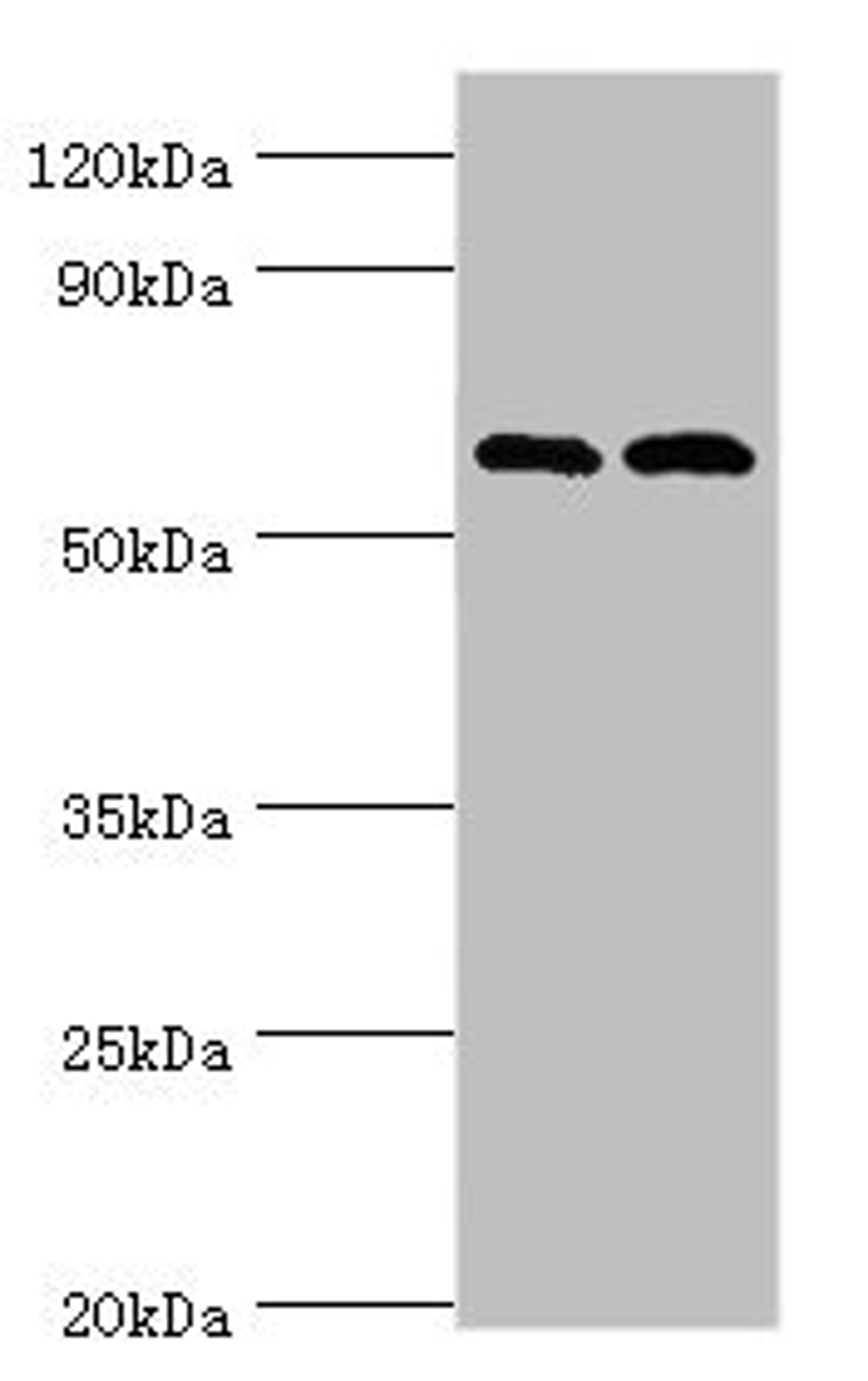 Western blot. All lanes: Serine/threonine-protein kinase PAK 2 antibody at 2ug/ml. Lane 1: Jurkat whole cell lysate. Lane 2: Hela whole cell lysate. Secondary. Goat polyclonal to rabbit IgG at 1/10000 dilution. Predicted band size: 58 kDa. Observed band size: 58 kDa.