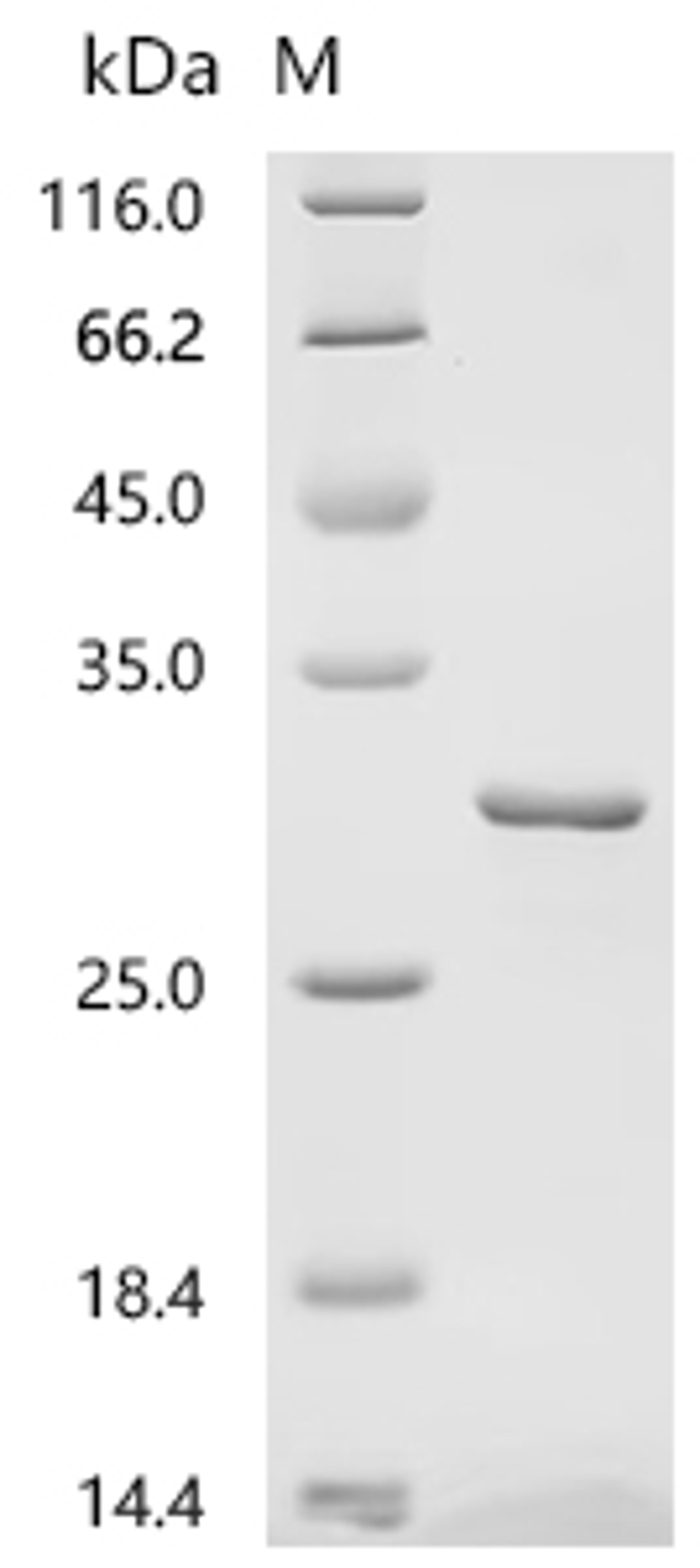 (Tris-Glycine gel) Discontinuous SDS-PAGE (reduced) with 5% enrichment gel and 15% separation gel.