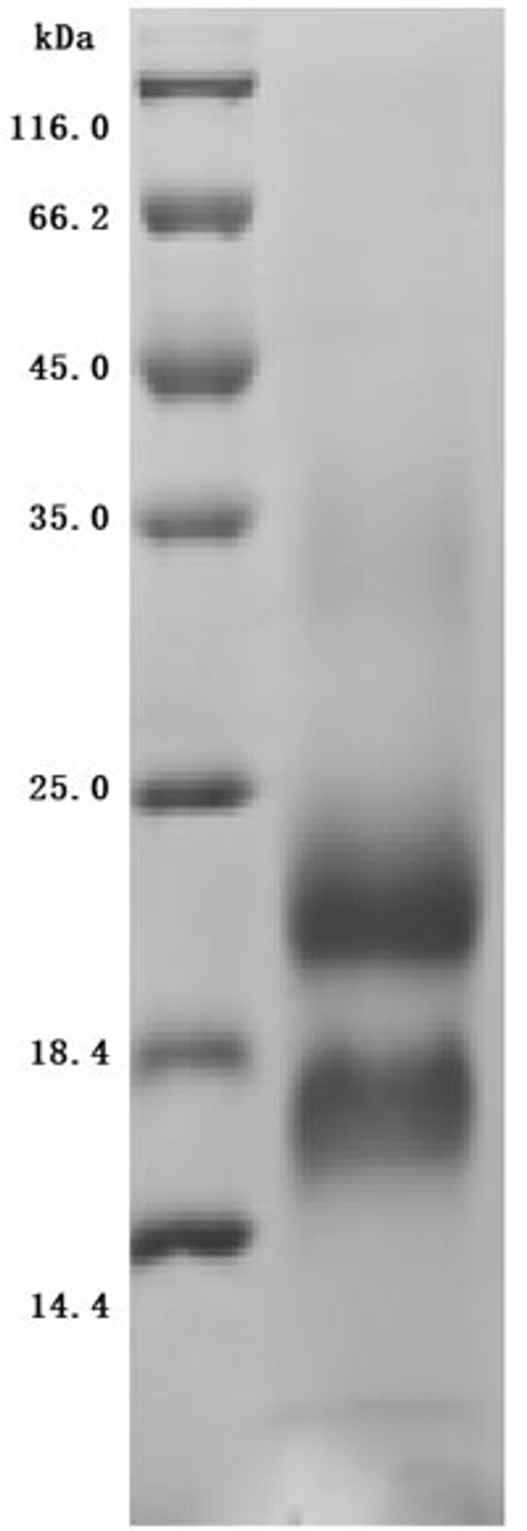 (Tris-Glycine gel) Discontinuous SDS-PAGE (reduced) with 5% enrichment gel and 15% separation gel.