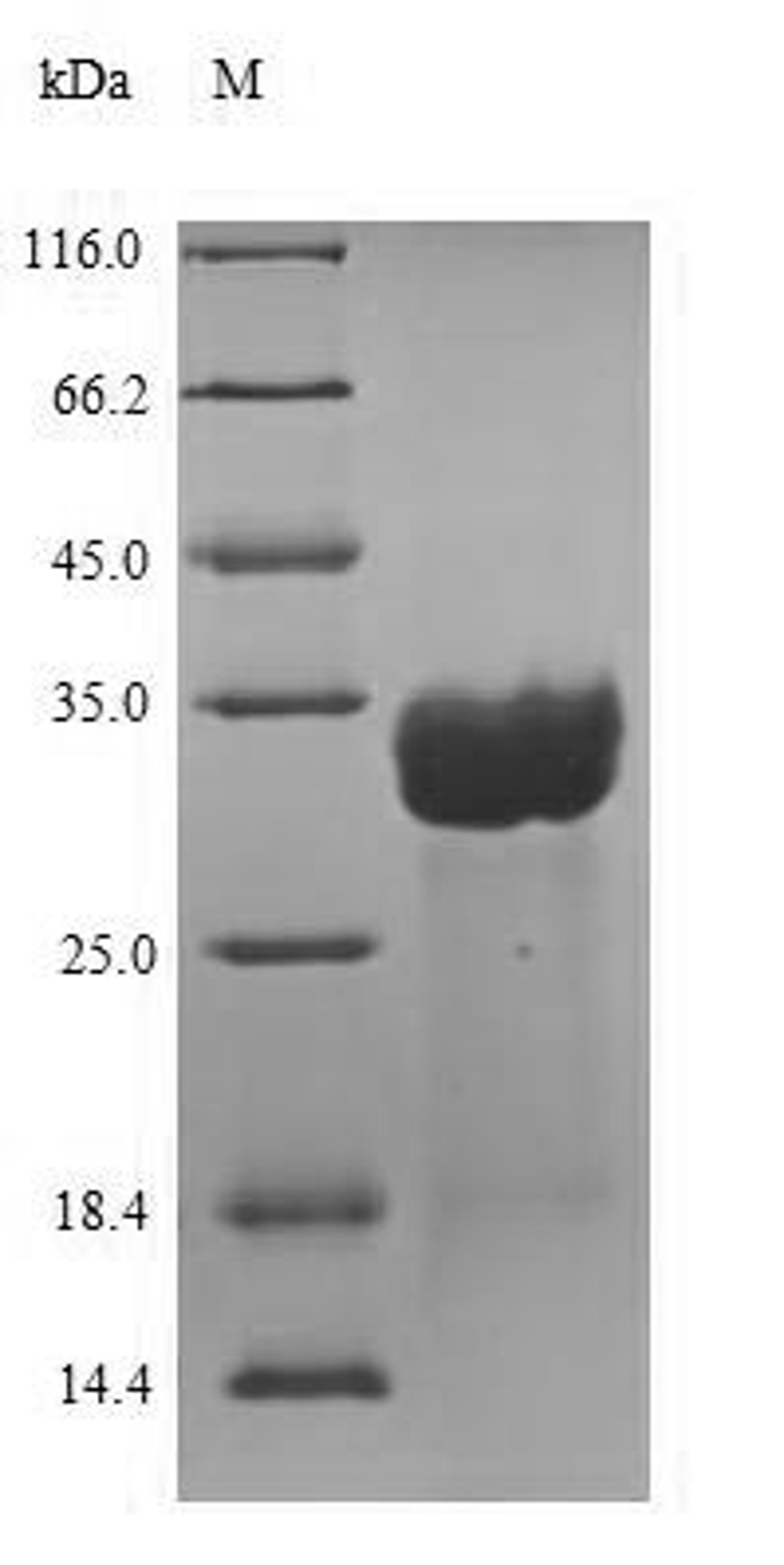 (Tris-Glycine gel) Discontinuous SDS-PAGE (reduced) with 5% enrichment gel and 15% separation gel.