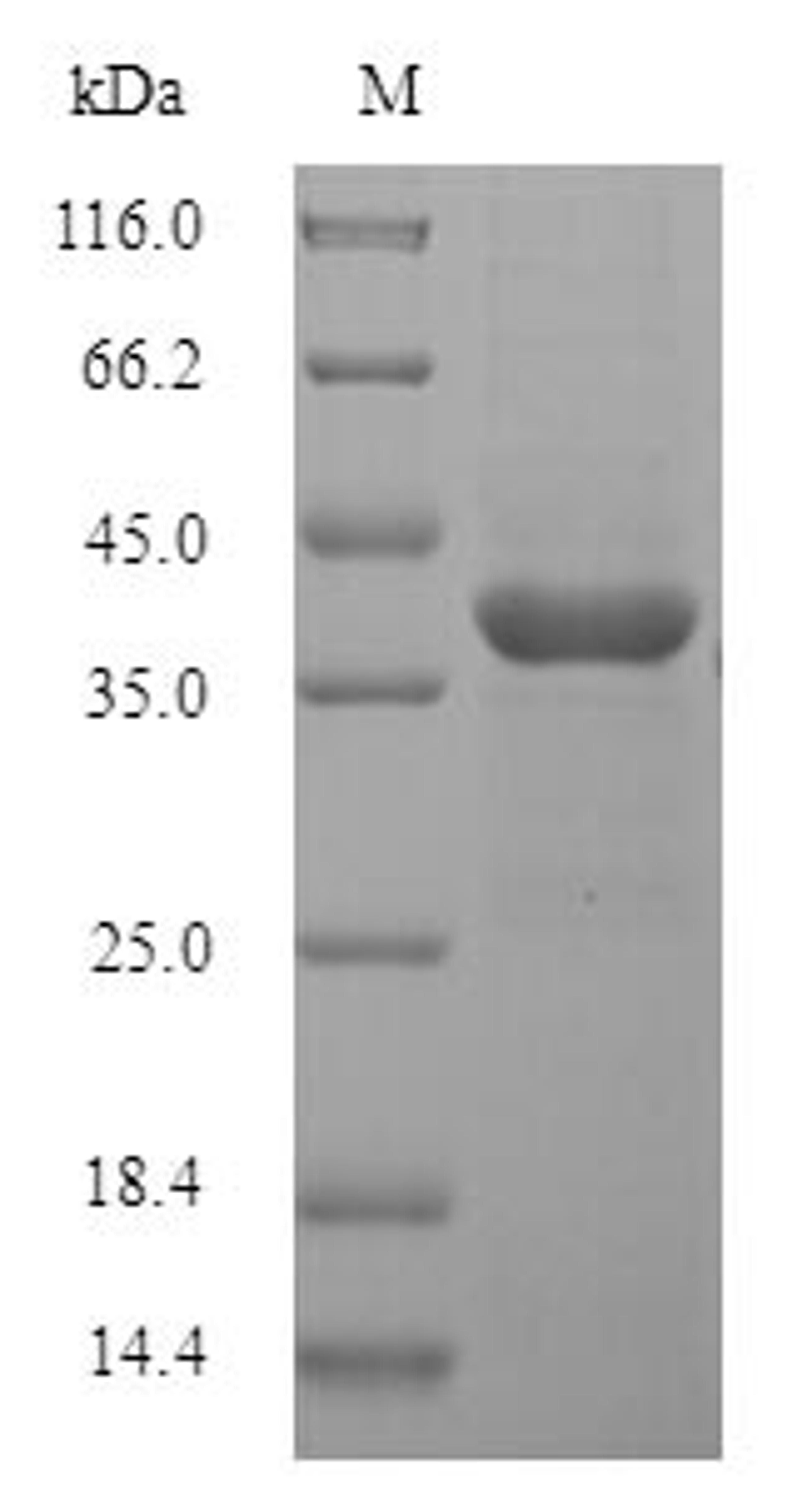 (Tris-Glycine gel) Discontinuous SDS-PAGE (reduced) with 5% enrichment gel and 15% separation gel.