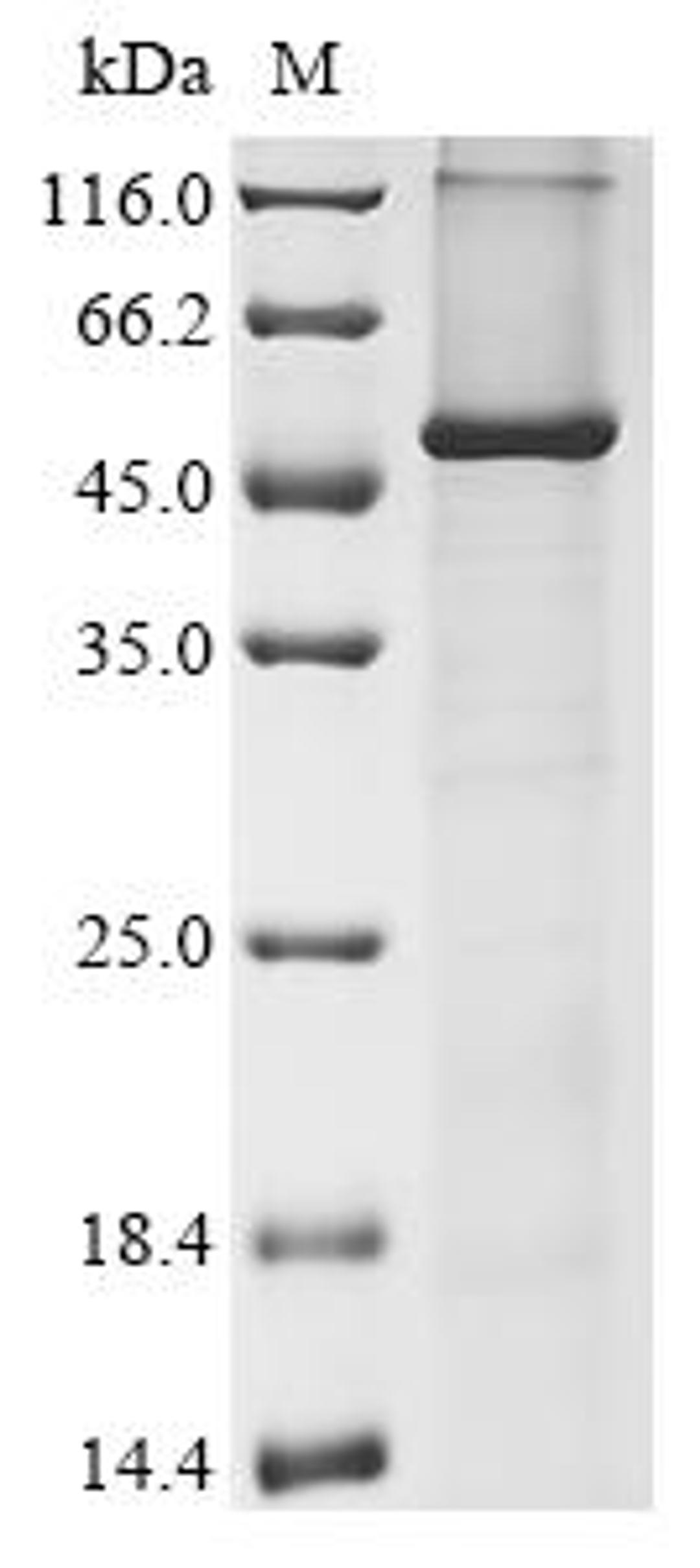 (Tris-Glycine gel) Discontinuous SDS-PAGE (reduced) with 5% enrichment gel and 15% separation gel.