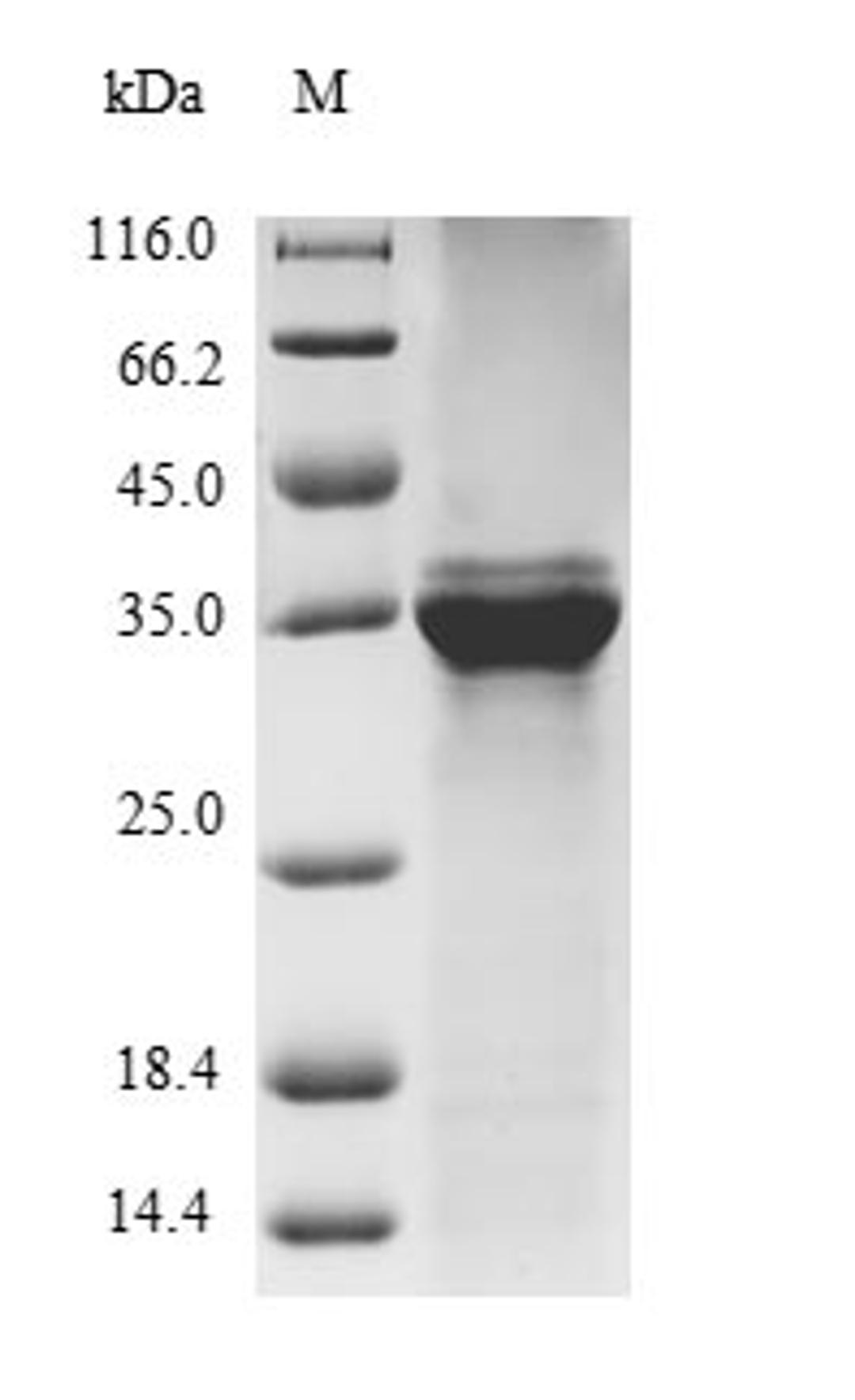 (Tris-Glycine gel) Discontinuous SDS-PAGE (reduced) with 5% enrichment gel and 15% separation gel.