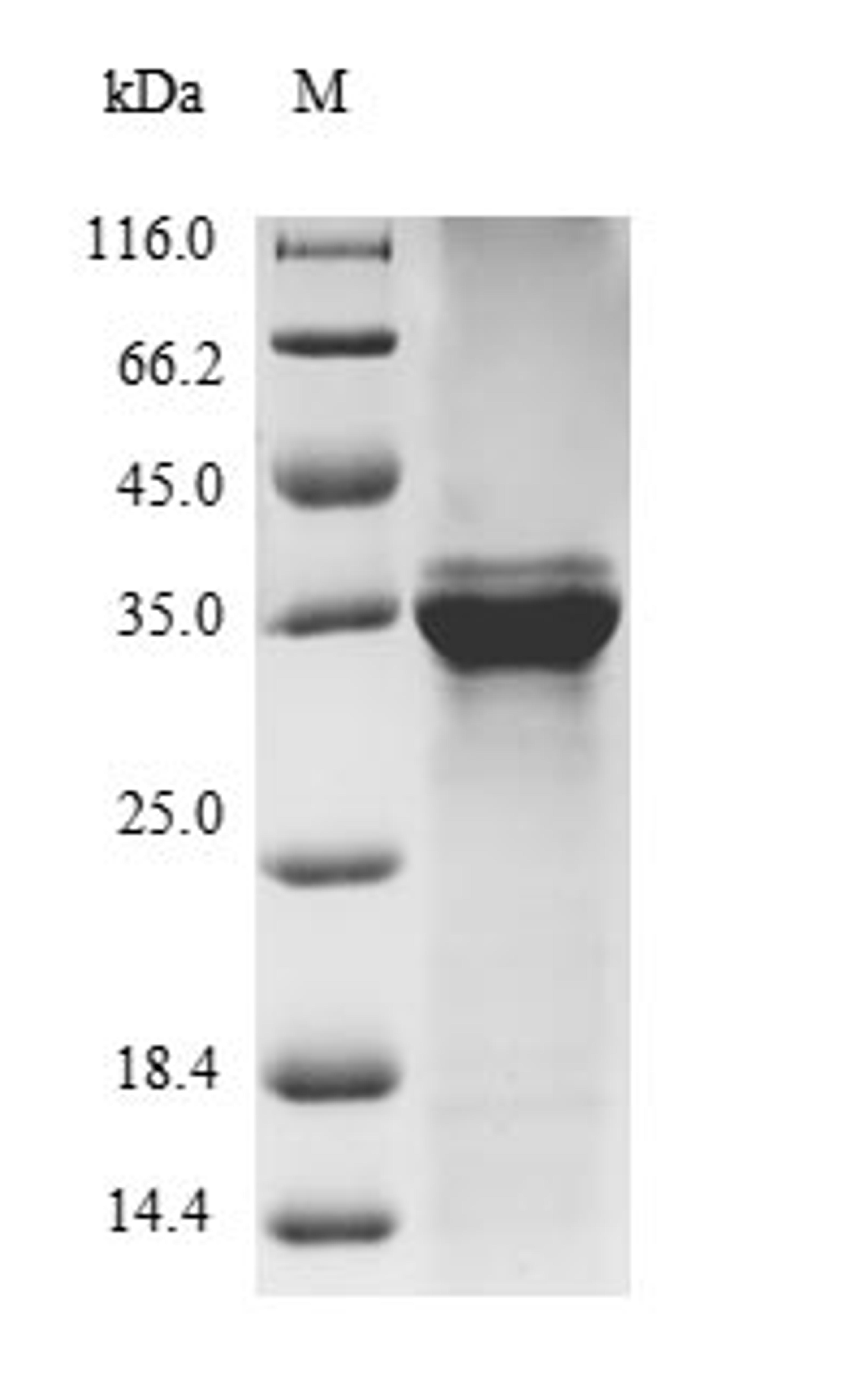 (Tris-Glycine gel) Discontinuous SDS-PAGE (reduced) with 5% enrichment gel and 15% separation gel.