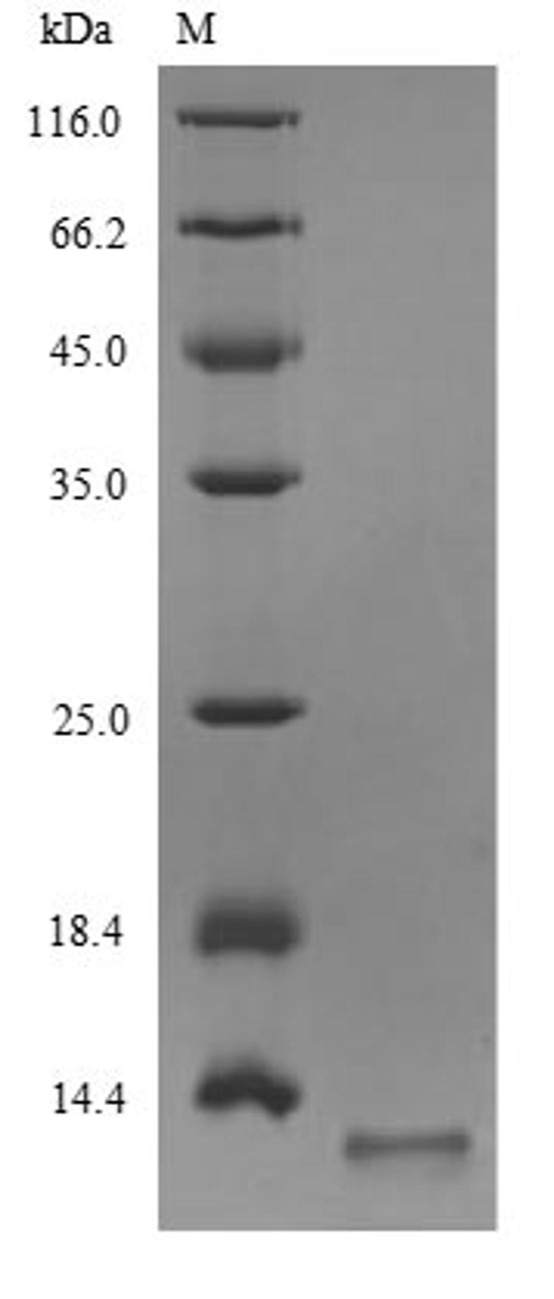 (Tris-Glycine gel) Discontinuous SDS-PAGE (reduced) with 5% enrichment gel and 15% separation gel.