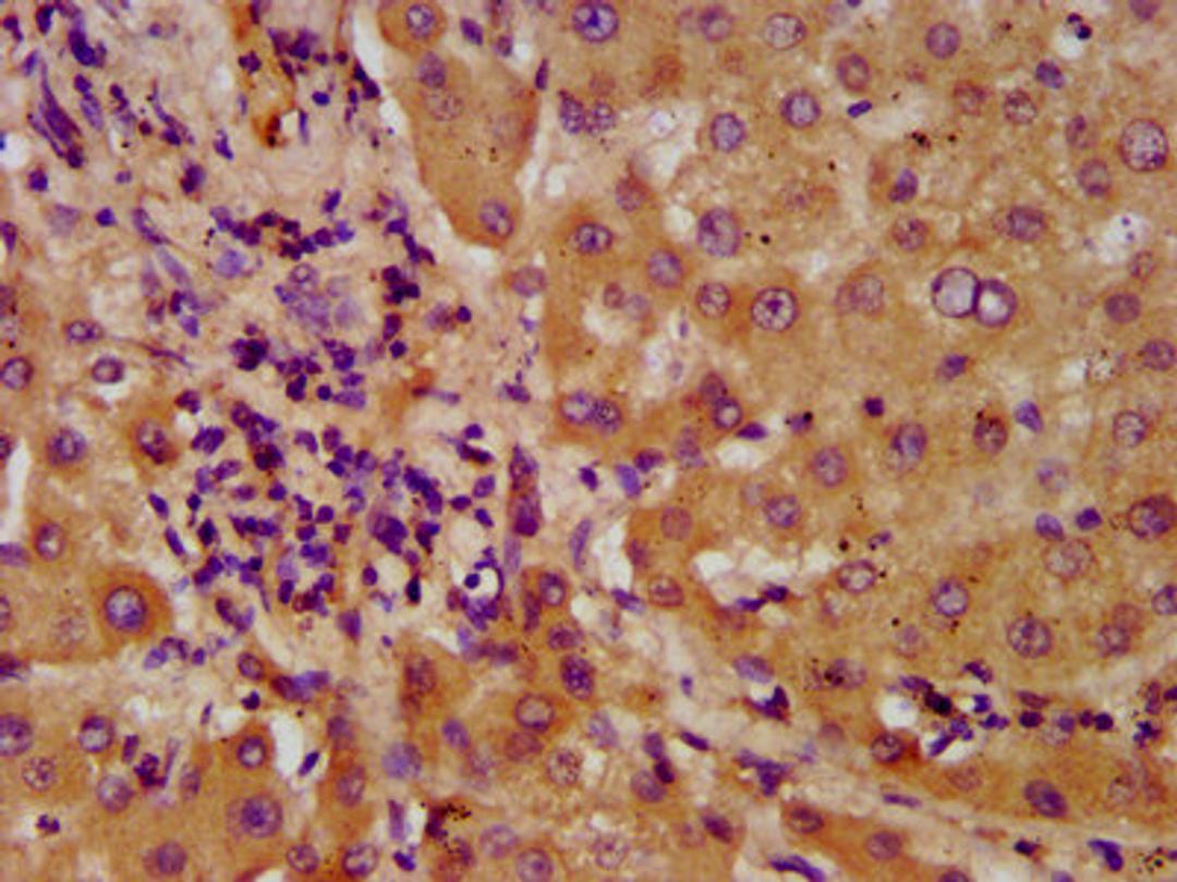 IHC image of CSB-PA891535LA01HU diluted at 1:600 and staining in paraffin-embedded human liver tissue performed on a Leica BondTM system. After dewaxing and hydration, antigen retrieval was mediated by high pressure in a citrate buffer (pH 6.0). Section was blocked with 10% normal goat serum 30min at RT. Then primary antibody (1% BSA) was incubated at 4&deg;C overnight. The primary is detected by a biotinylated secondary antibody and visualized using an HRP conjugated SP system.