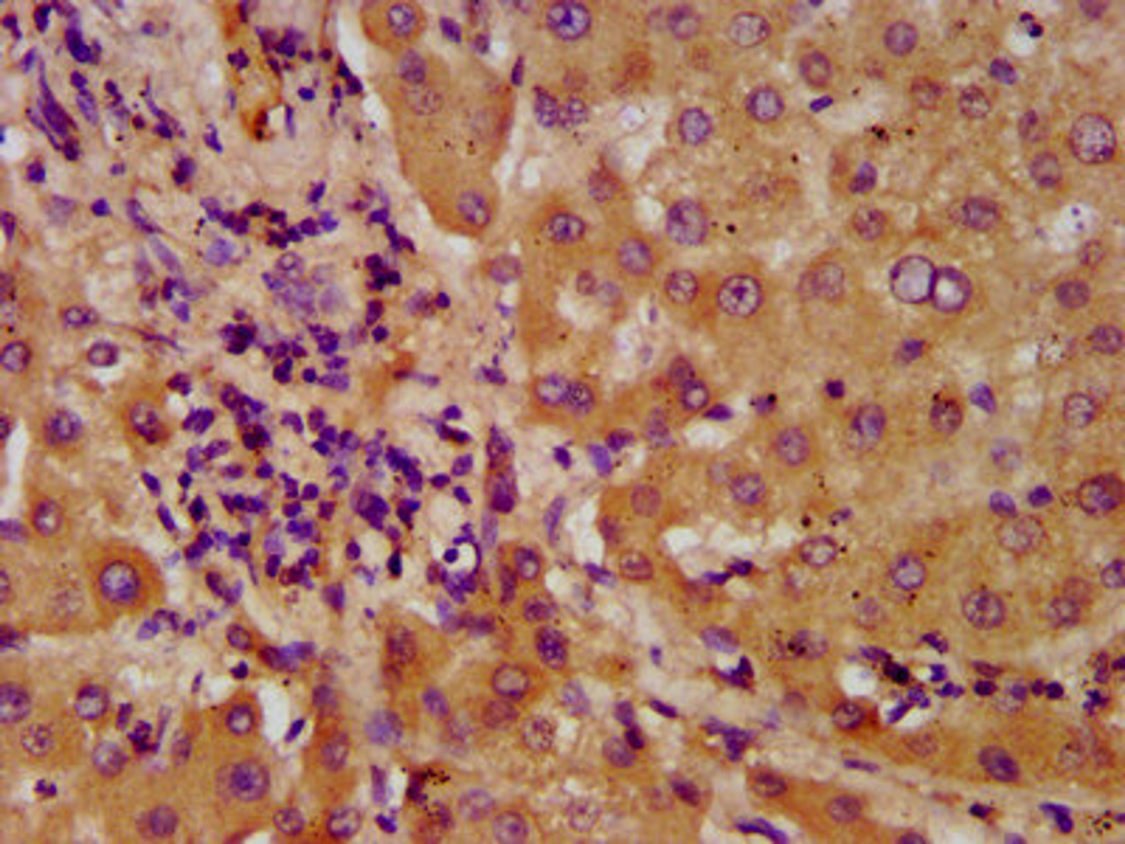 IHC image of CSB-PA891535LA01HU diluted at 1:600 and staining in paraffin-embedded human liver tissue performed on a Leica BondTM system. After dewaxing and hydration, antigen retrieval was mediated by high pressure in a citrate buffer (pH 6.0). Section was blocked with 10% normal goat serum 30min at RT. Then primary antibody (1% BSA) was incubated at 4&deg;C overnight. The primary is detected by a biotinylated secondary antibody and visualized using an HRP conjugated SP system.