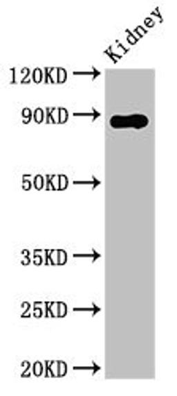 Western Blot. Positive WB detected in: Rat kidney tissue. All lanes: DPP4 antibody at 2.8ug/ml. Secondary. Goat polyclonal to rabbit IgG at 1/50000 dilution. Predicted band size: 89 kDa. Observed band size: 89 kDa. 