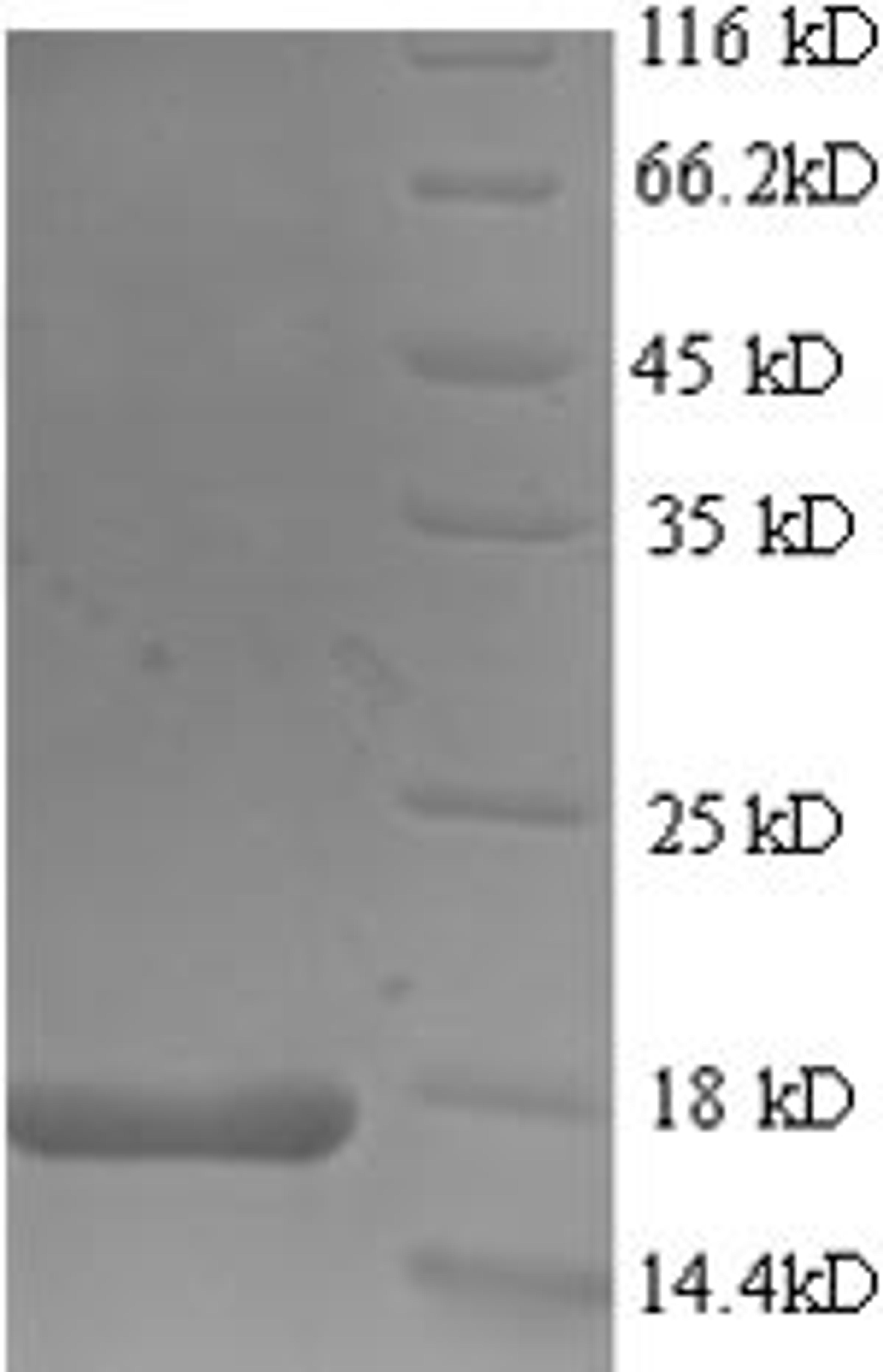 (Tris-Glycine gel) Discontinuous SDS-PAGE (reduced) with 5% enrichment gel and 15% separation gel.