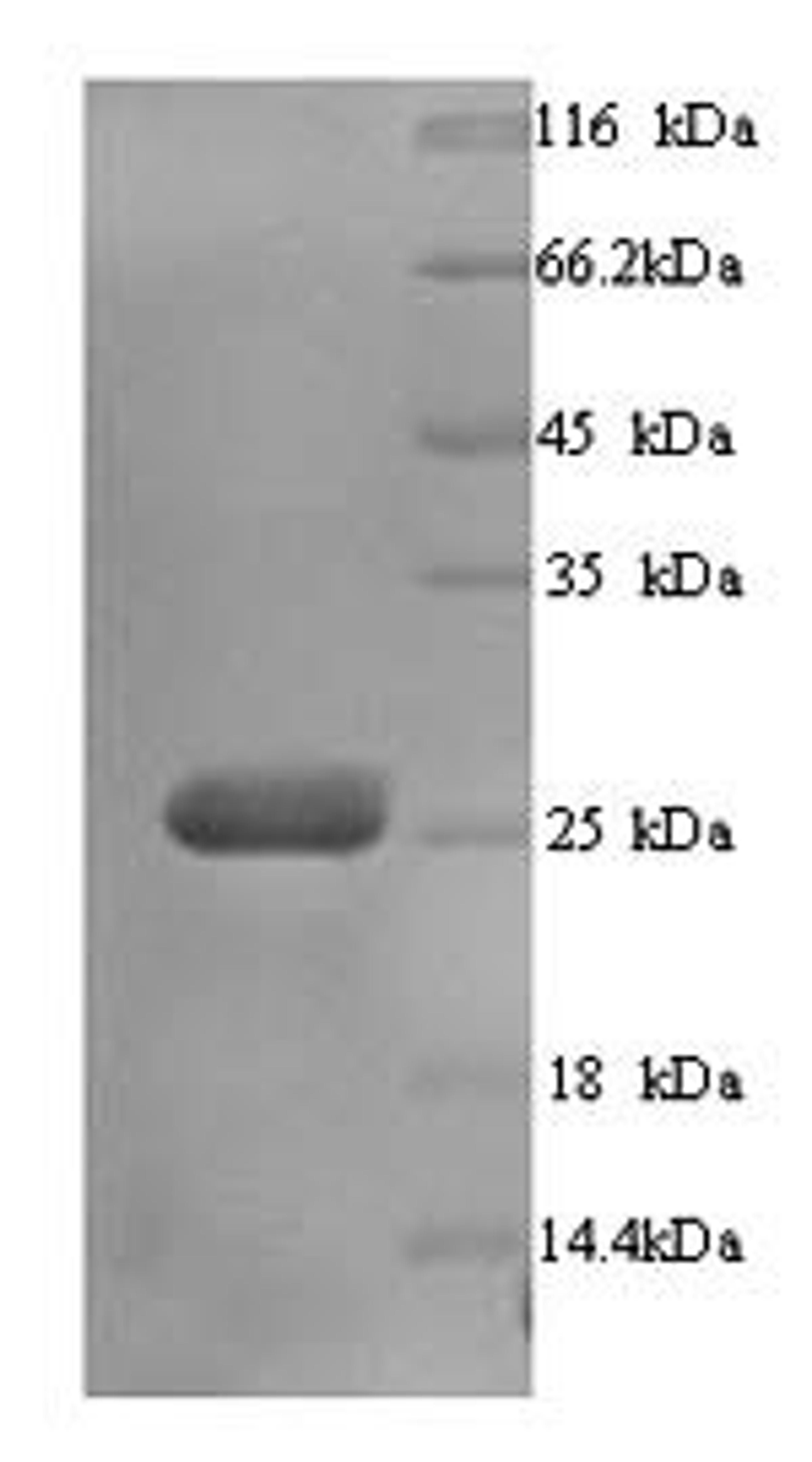 (Tris-Glycine gel) Discontinuous SDS-PAGE (reduced) with 5% enrichment gel and 15% separation gel.