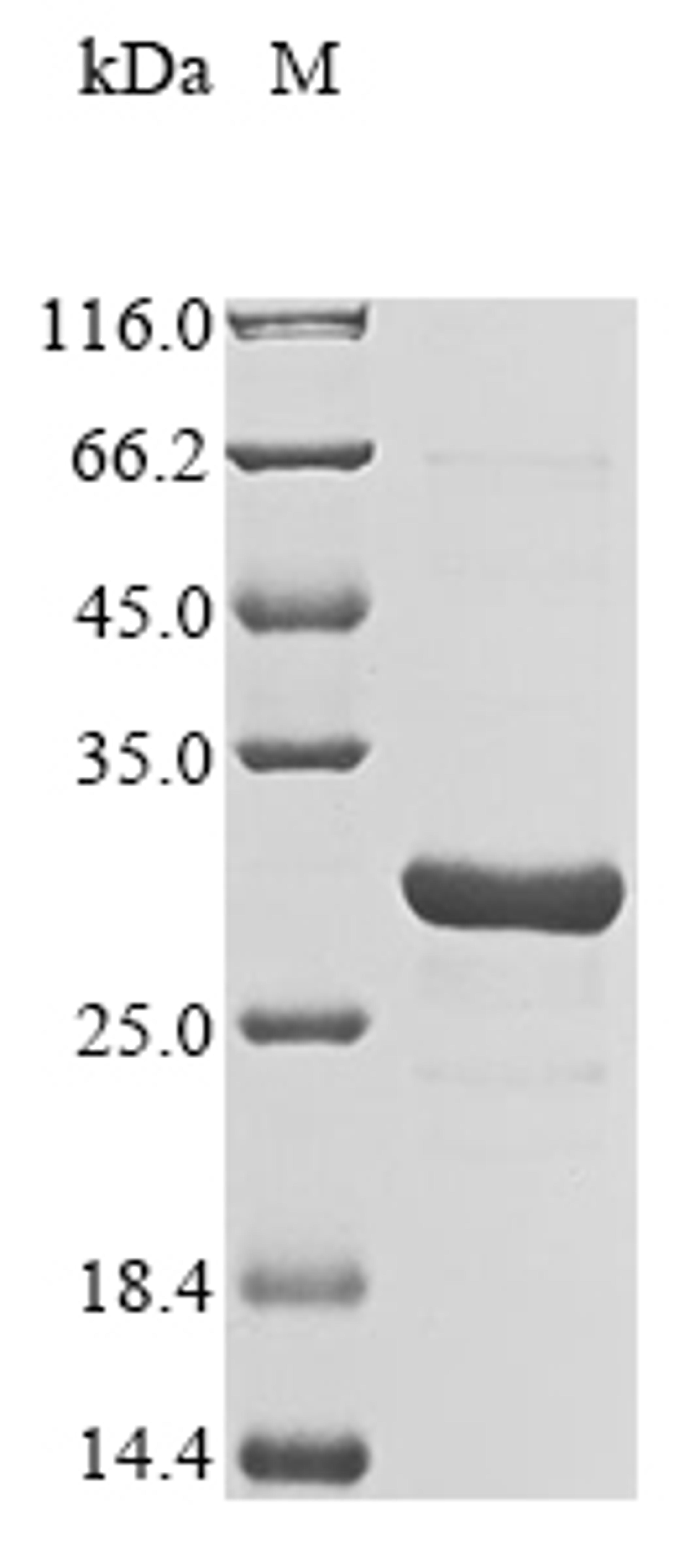 (Tris-Glycine gel) Discontinuous SDS-PAGE (reduced) with 5% enrichment gel and 15% separation gel.