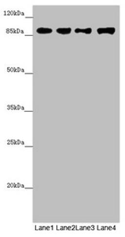 Western blot. All lanes: COG4 antibody at 4.85µg/ml. Lane 1: Mouse liver tissue. Lane 2: Mouse gonadal tissue. Lane 3: K562 whole cell lysate. Lane 4: Hela whole cell lysate. Secondary. Goat polyclonal to rabbit IgG at 1/10000 dilution. Predicted band size: 90, 39, 82 kDa. Observed band size: 90 kDa