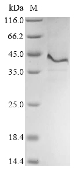 (Tris-Glycine gel) Discontinuous SDS-PAGE (reduced) with 5% enrichment gel and 15% separation gel.