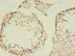 Immunohistochemistry of paraffin-embedded human testis tissue using CSB-PA009147LA01HU at dilution of 1:100
