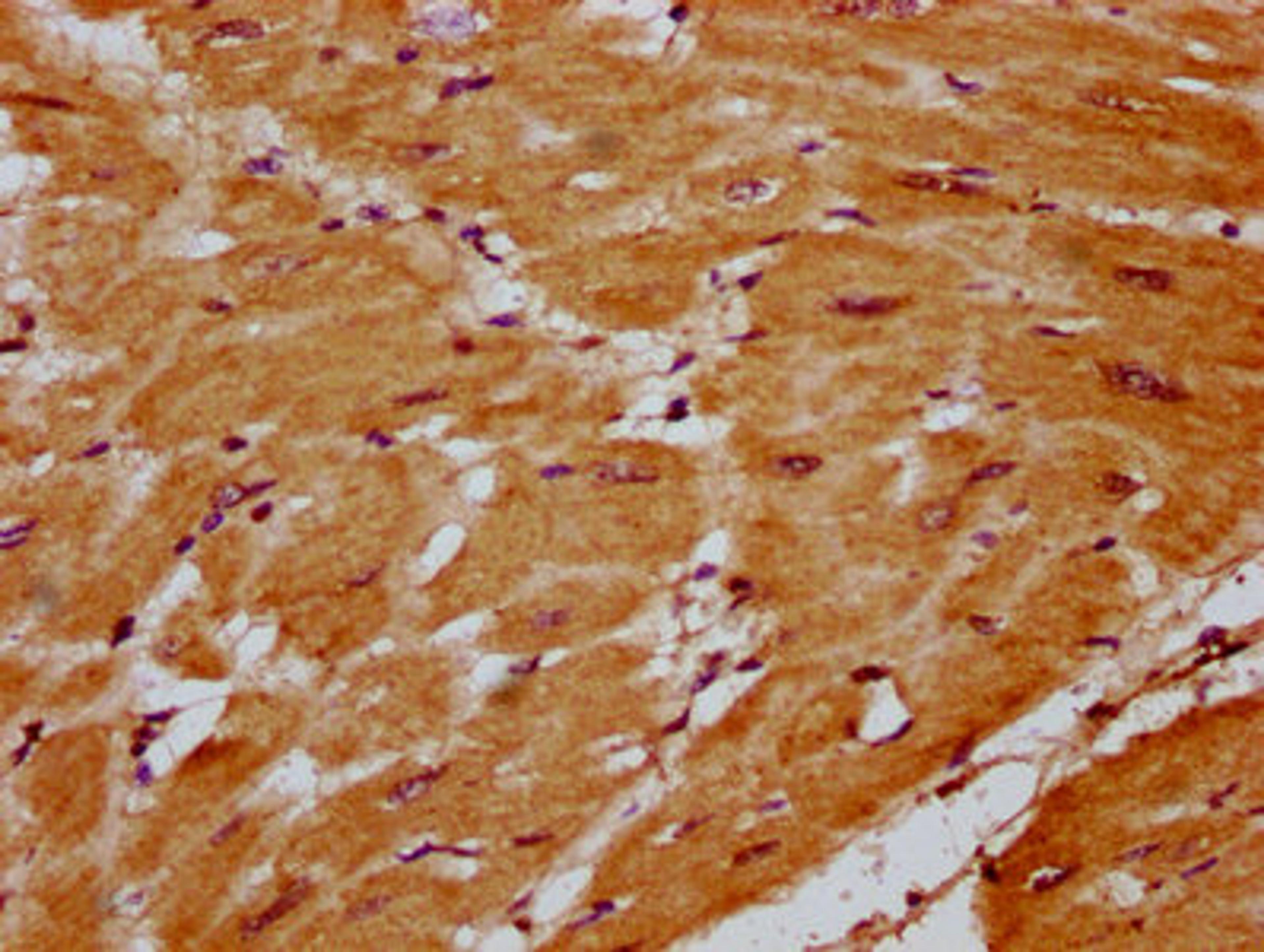 IHC image of CSB-PA810274LA01HU diluted at 1:400 and staining in paraffin-embedded human heart tissue performed on a Leica BondTM system. After dewaxing and hydration, antigen retrieval was mediated by high pressure in a citrate buffer (pH 6.0). Section was blocked with 10% normal goat serum 30min at RT. Then primary antibody (1% BSA) was incubated at 4&deg;C overnight. The primary is detected by a biotinylated secondary antibody and visualized using an HRP conjugated SP system.