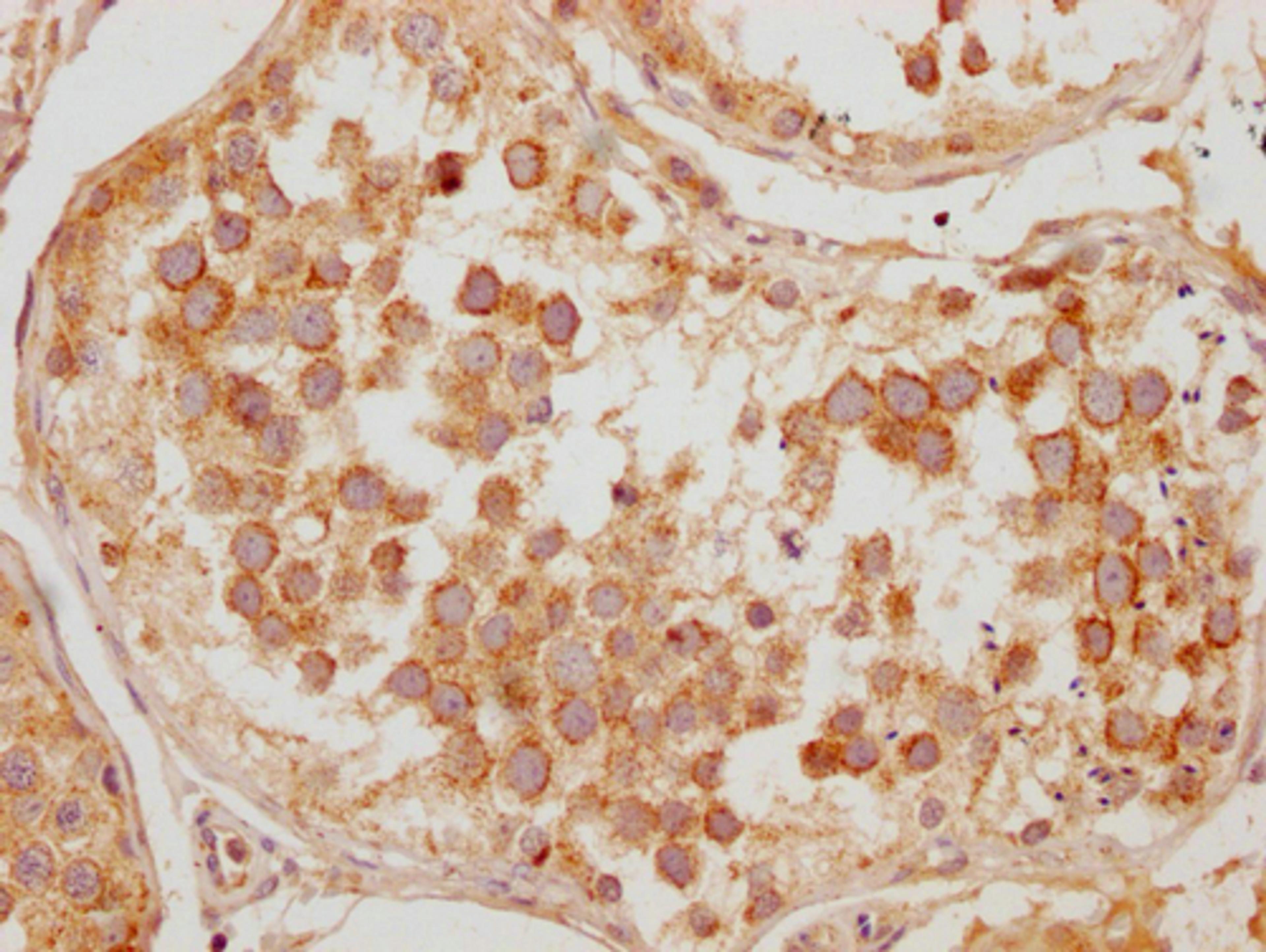 IHC image of CSB-PA823893LA01HU diluted at 1:200 and staining in paraffin-embedded human testis tissue performed on a Leica BondTM system. After dewaxing and hydration, antigen retrieval was mediated by high pressure in a citrate buffer (pH 6.0). Section was blocked with 10% normal goat serum 30min at RT. Then primary antibody (1% BSA) was incubated at 4°C overnight. The primary is detected by a Goat anti-rabbit polymer IgG labeled by HRP and visualized using 0.05% DAB.