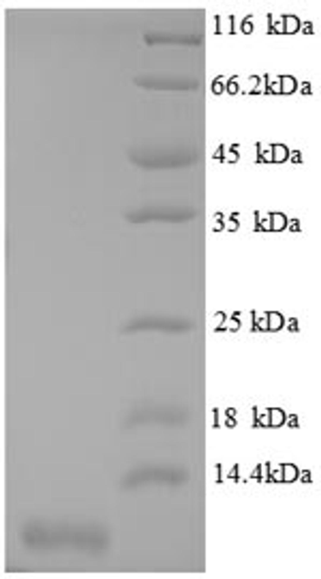 (Tris-Glycine gel) Discontinuous SDS-PAGE (reduced) with 5% enrichment gel and 15% separation gel.