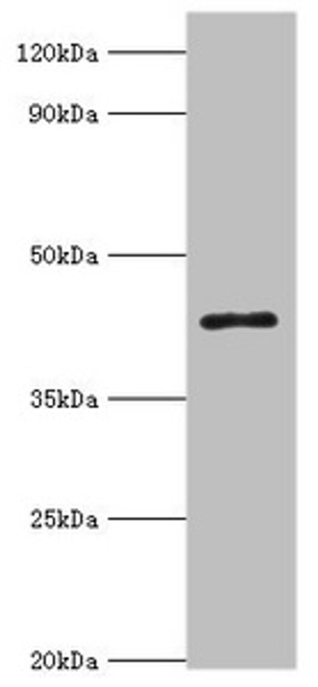Western blot. All lanes: 3-ketoacyl-CoA thiolase, peroxisomal antibody at 8ug/ml + Mouse liver tissue. Secondary. Goat polyclonal to rabbit IgG at 1/10000 dilution. Predicted band size: 45, 35 kDa. Observed band size: 45 kDa. 