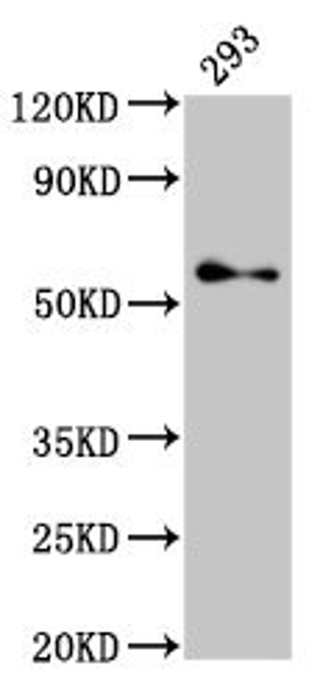 Western Blot. Positive WB detected in: 293 whole cell lysate. All lanes: TFE3 antibody at 2.7µg/ml. Secondary. Goat polyclonal to rabbit IgG at 1/50000 dilution. Predicted band size: 62, 12 kDa. Observed band size: 62 kDa