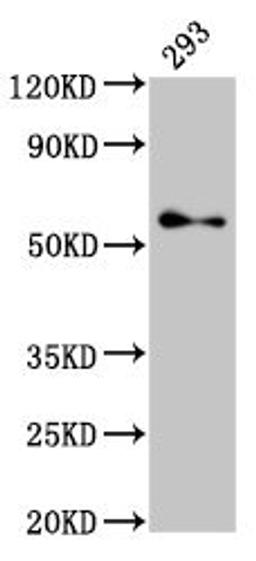 Western Blot. Positive WB detected in: 293 whole cell lysate. All lanes: TFE3 antibody at 2.7µg/ml. Secondary. Goat polyclonal to rabbit IgG at 1/50000 dilution. Predicted band size: 62, 12 kDa. Observed band size: 62 kDa