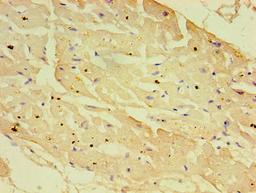 Immunohistochemistry of paraffin-embedded human heart tissue using CSB-PA016221LA01HU at dilution of 1:100