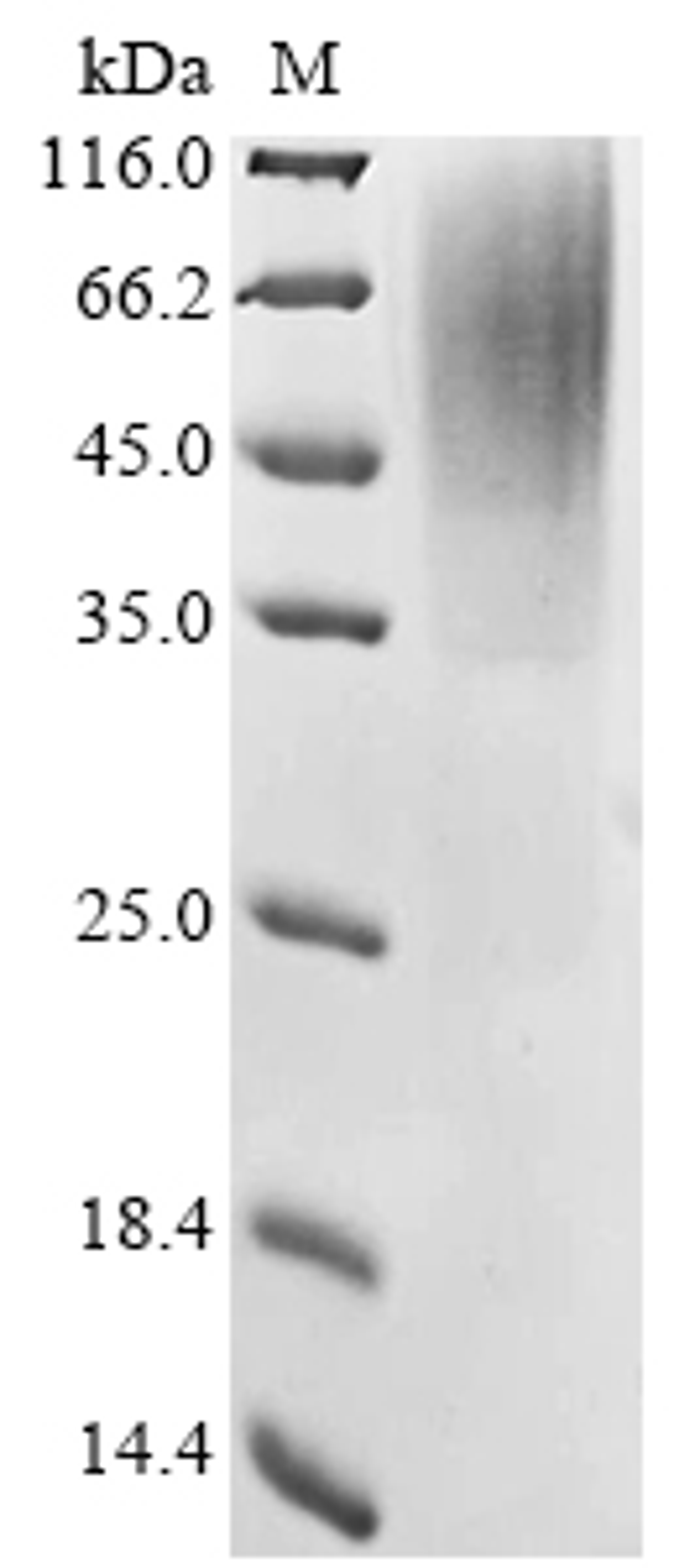 (Tris-Glycine gel) Discontinuous SDS-PAGE (reduced) with 5% enrichment gel and 15% separation gel.