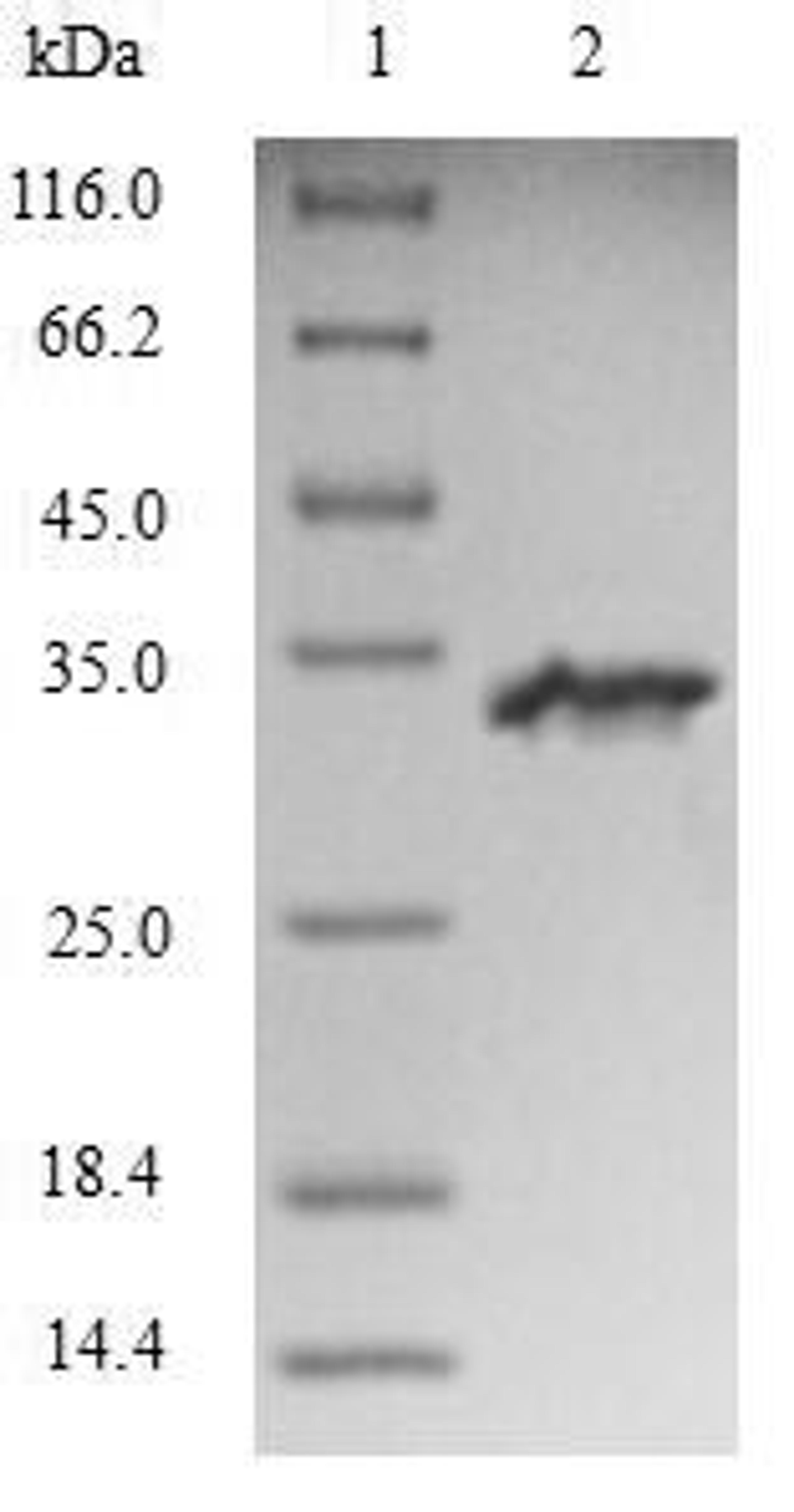 (Tris-Glycine gel) Discontinuous SDS-PAGE (reduced) with 5% enrichment gel and 15% separation gel.