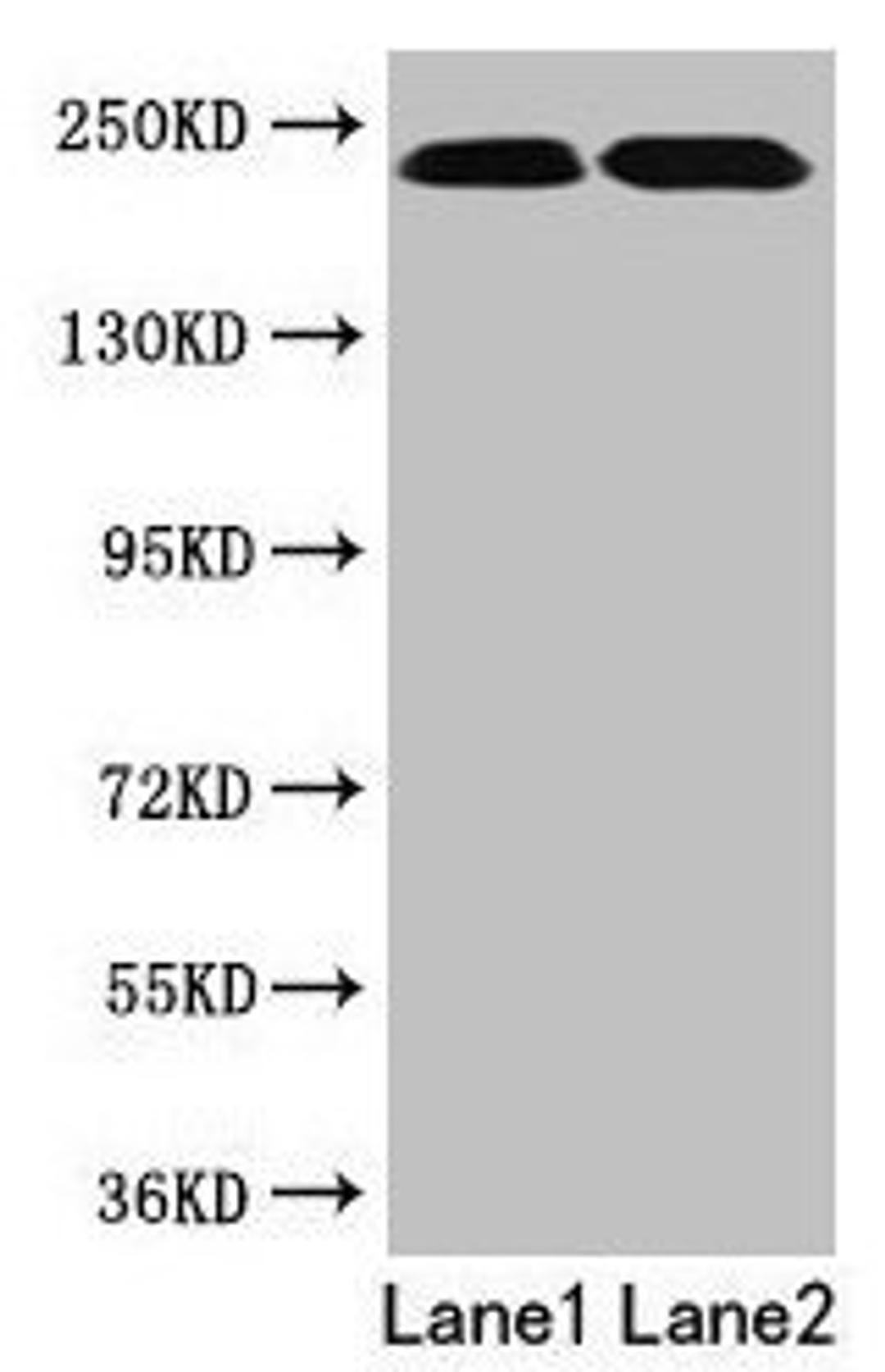 Western blot. All lanes: TLN2 antibody at 12µg/ml. Lane 1: Hela whole cell lysate. Lane 2: Jurkat whole cell lysate. Secondary. Goat polyclonal to rabbit IgG at 1/10000 dilution. Predicted band size: 272 kDa. Observed band size: 230 kDa