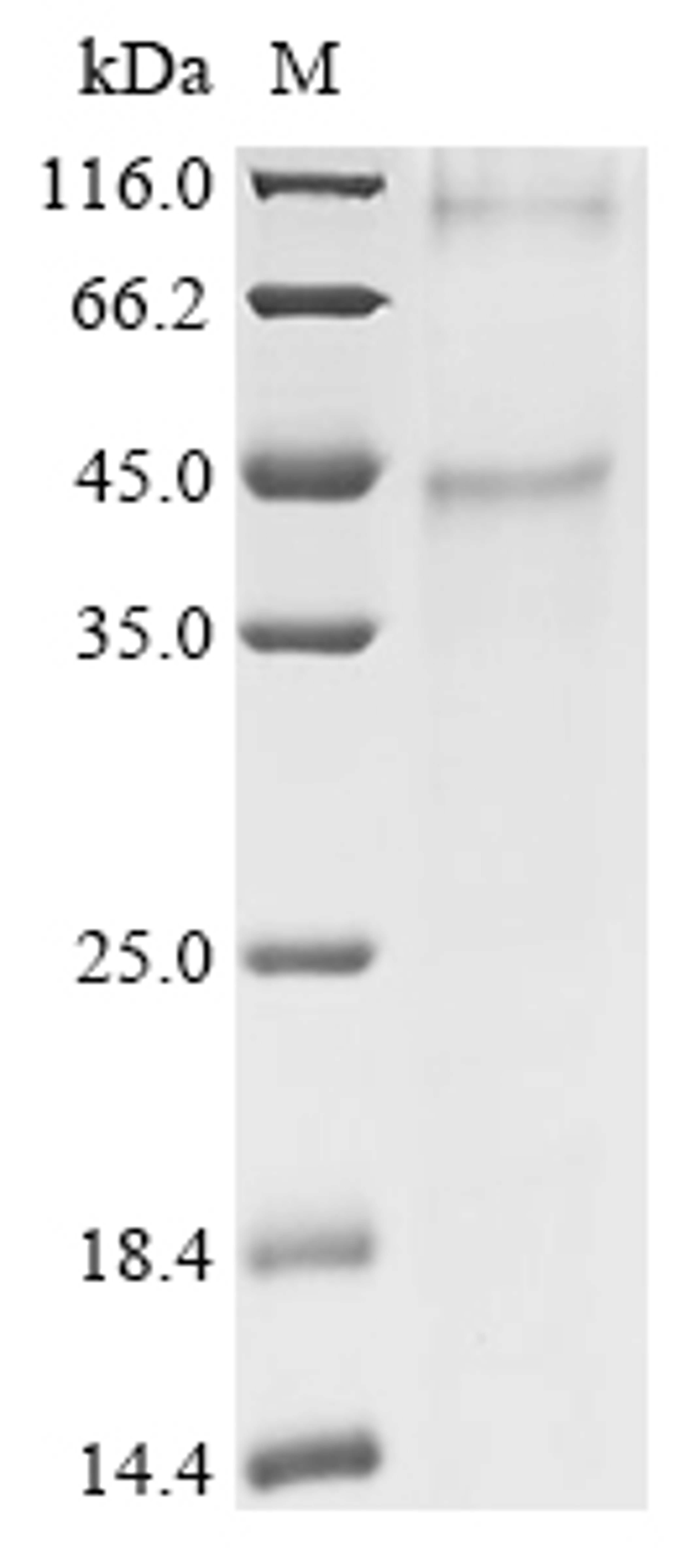 (Tris-Glycine gel) Discontinuous SDS-PAGE (reduced) with 5% enrichment gel and 15% separation gel.