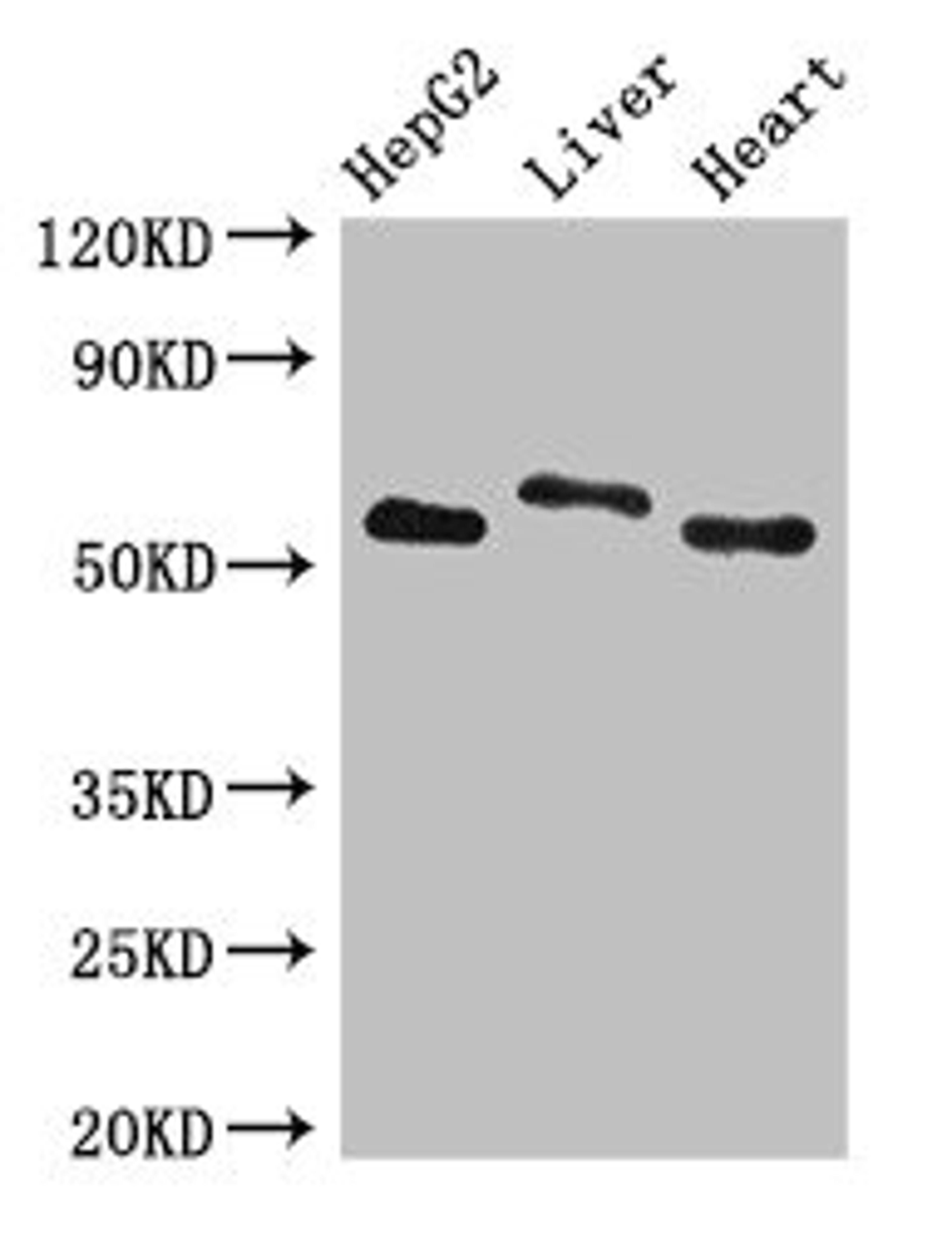 Western Blot. Positive WB detected in: HepG2 whole cell lysate, Rat liver tissue, Mouse heart tissue. All lanes: SLC13A5 antibody at 2.7ug/ml. Secondary. Goat polyclonal to rabbit IgG at 1/50000 dilution. Predicted band size: 64, 59, 62 kDa. Observed band size: 64, 59 kDa.