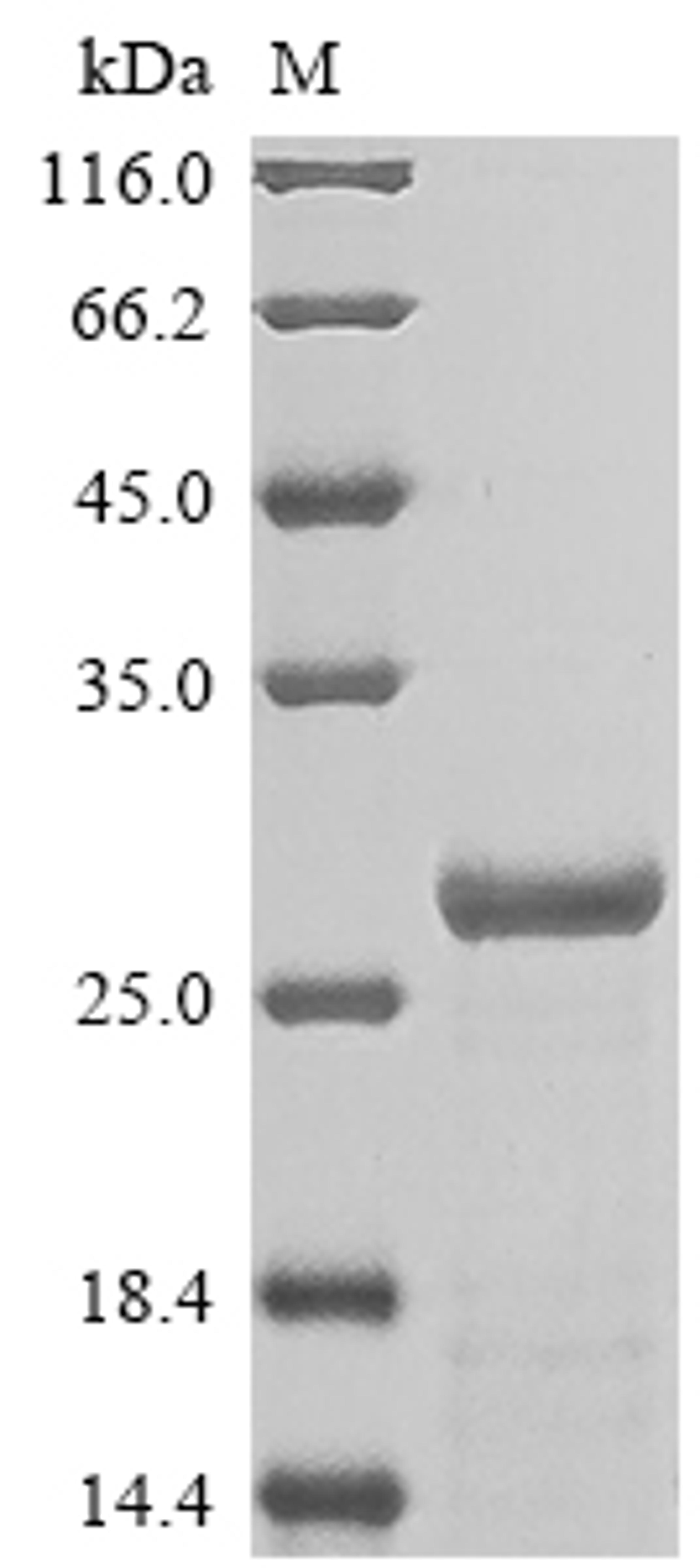 (Tris-Glycine gel) Discontinuous SDS-PAGE (reduced) with 5% enrichment gel and 15% separation gel.