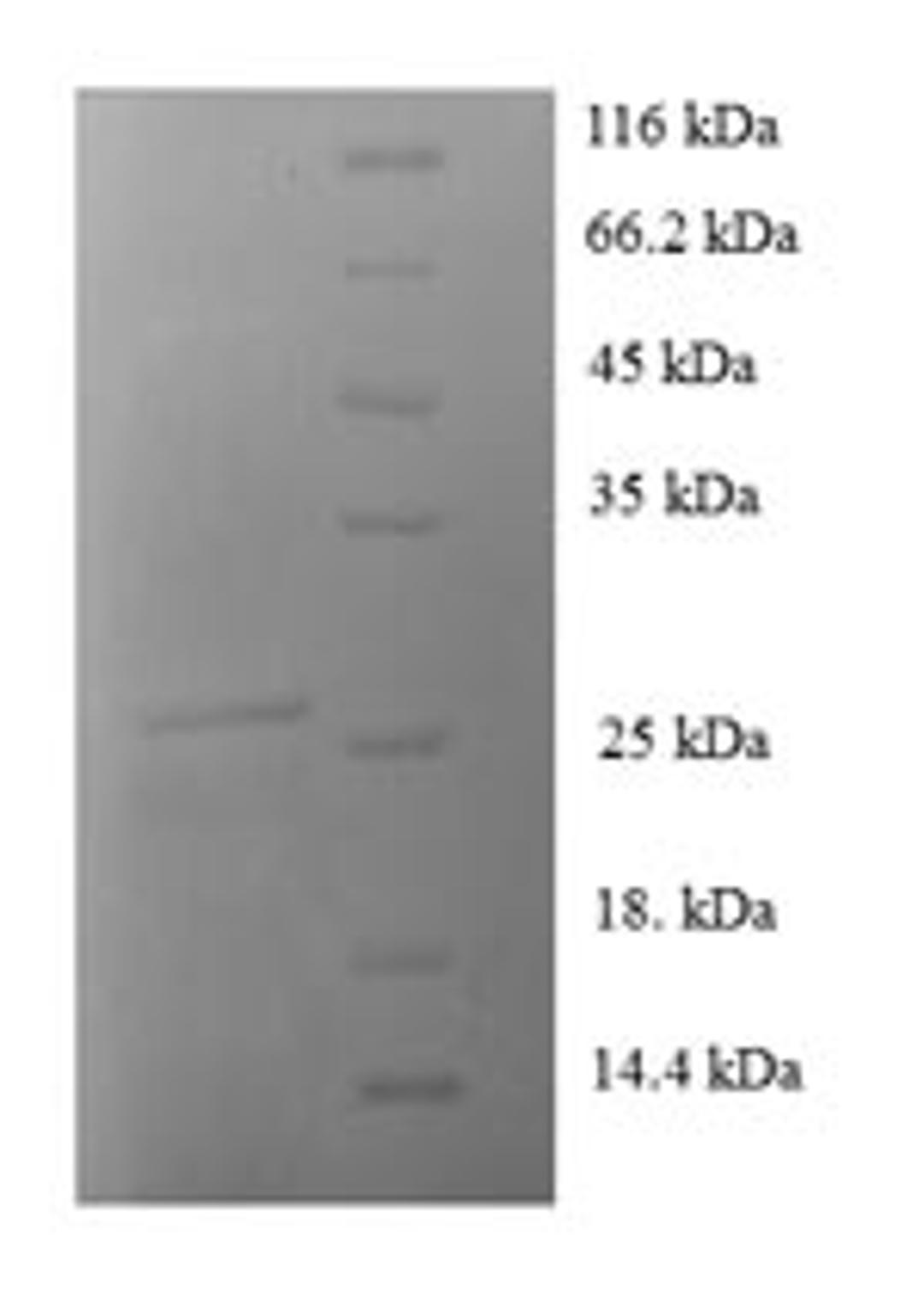 (Tris-Glycine gel) Discontinuous SDS-PAGE (reduced) with 5% enrichment gel and 15% separation gel.