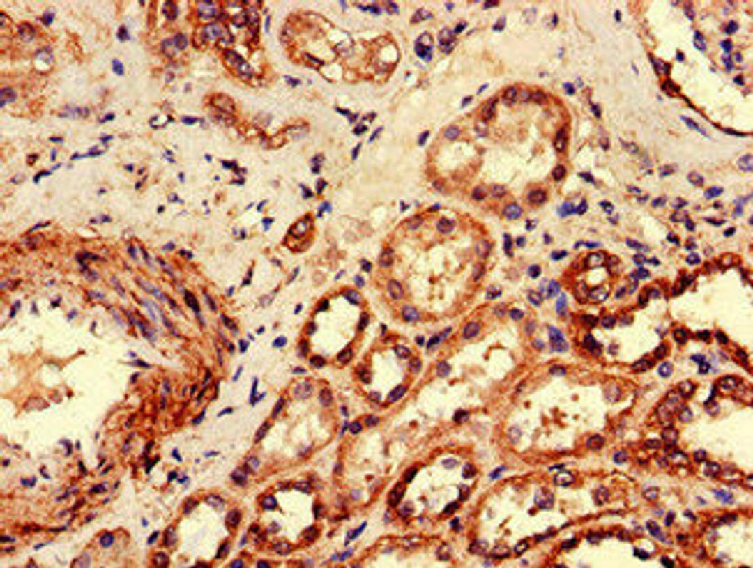 Immunohistochemistry of paraffin-embedded human kidney tissue using CSB-PA730130LA01HU at dilution of 1:100