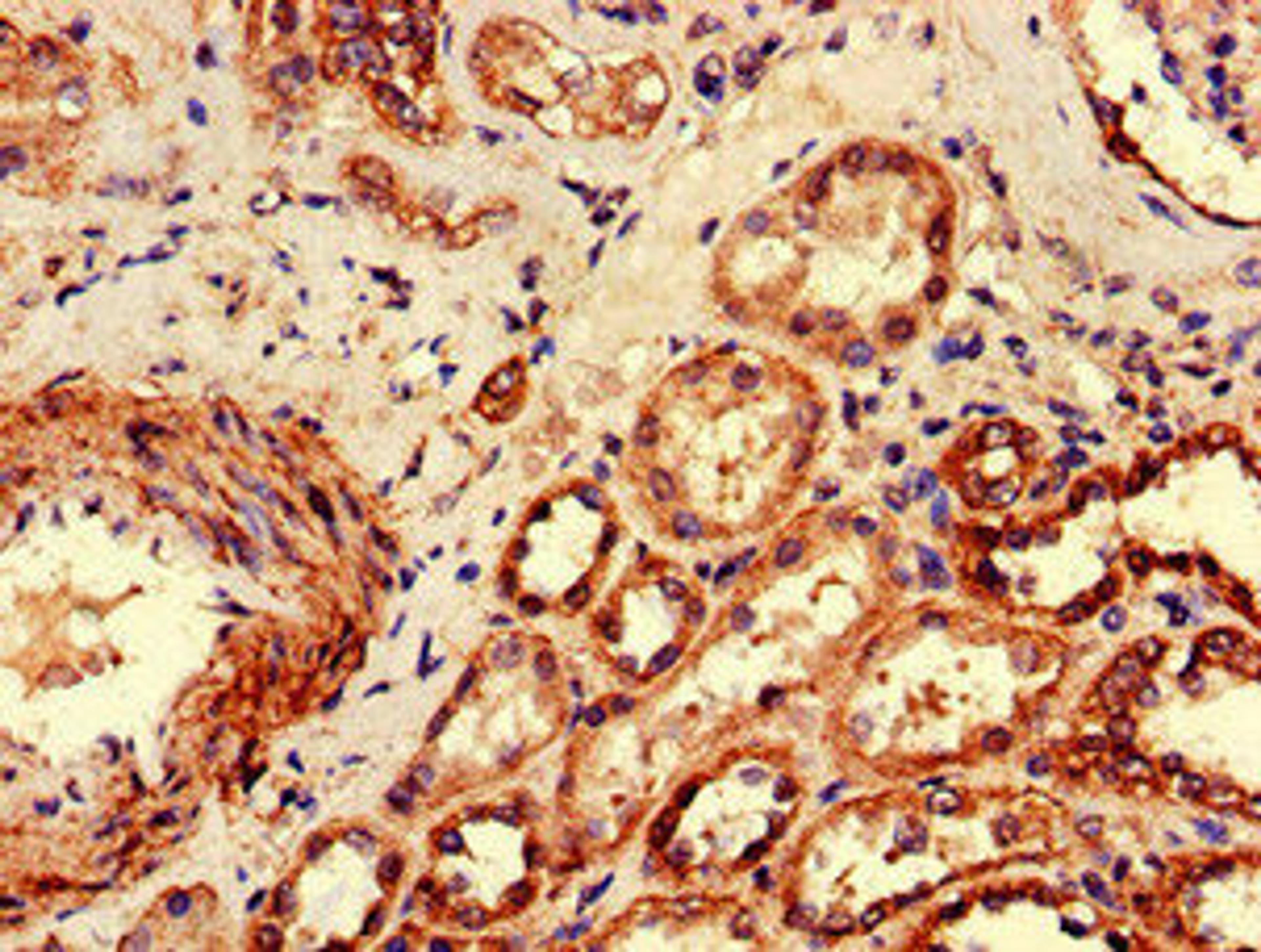 Immunohistochemistry of paraffin-embedded human kidney tissue using CSB-PA730130LA01HU at dilution of 1:100