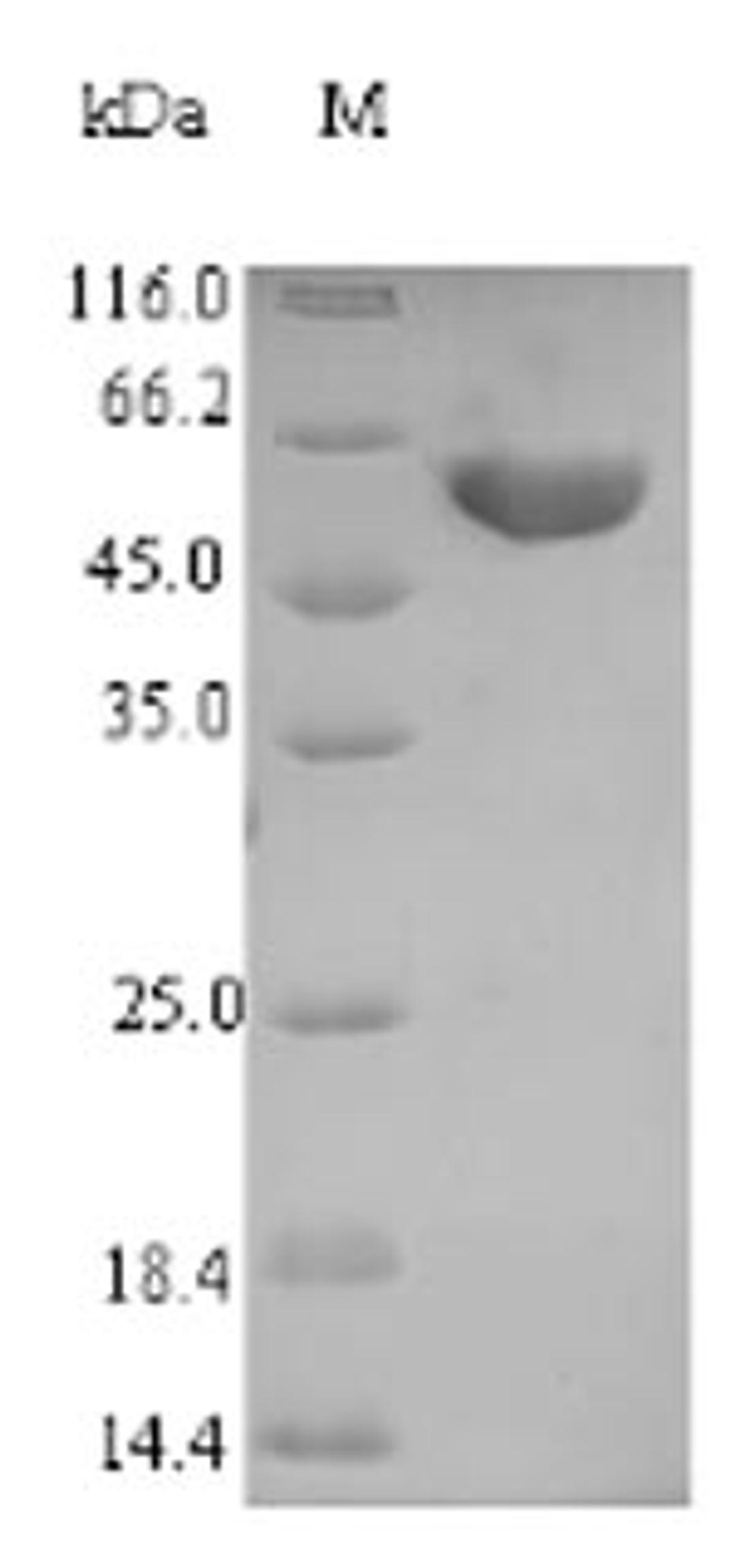 (Tris-Glycine gel) Discontinuous SDS-PAGE (reduced) with 5% enrichment gel and 15% separation gel.