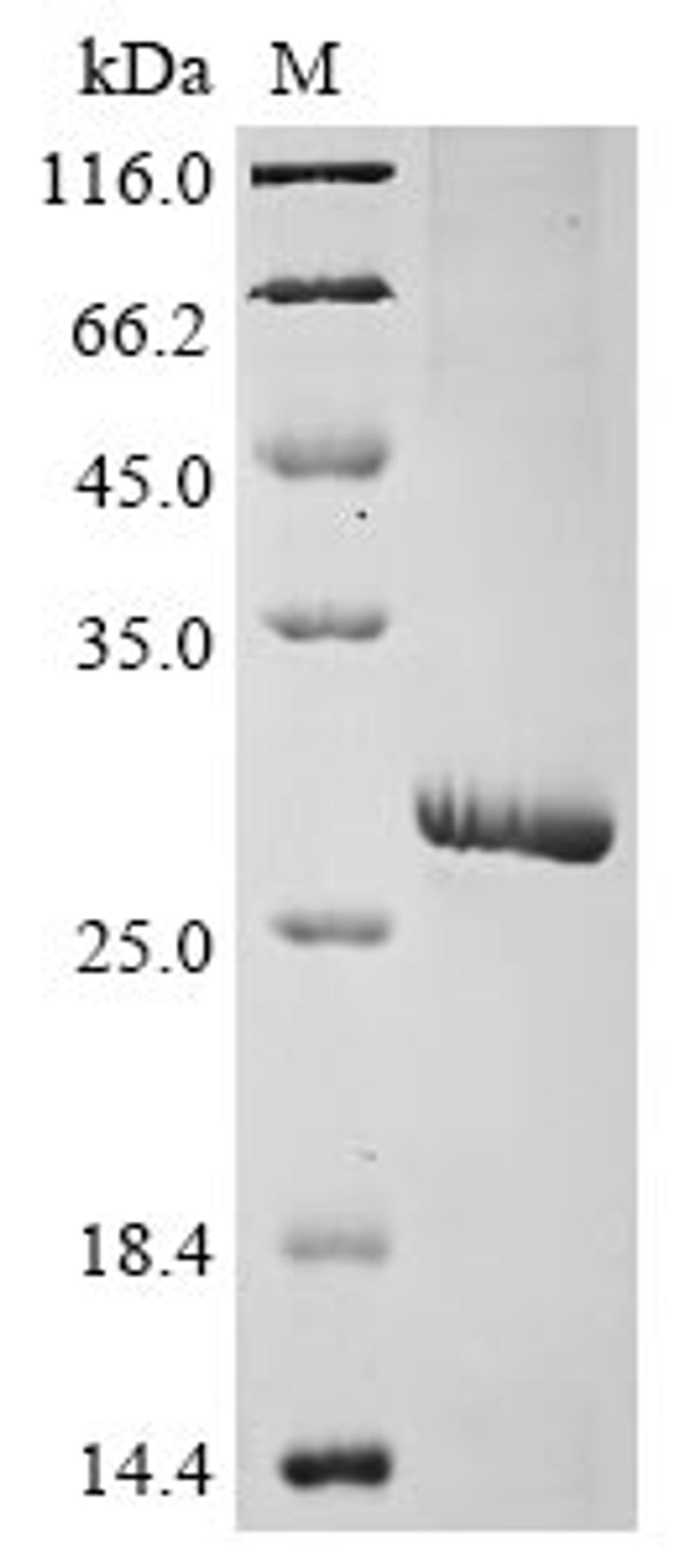 (Tris-Glycine gel) Discontinuous SDS-PAGE (reduced) with 5% enrichment gel and 15% separation gel.