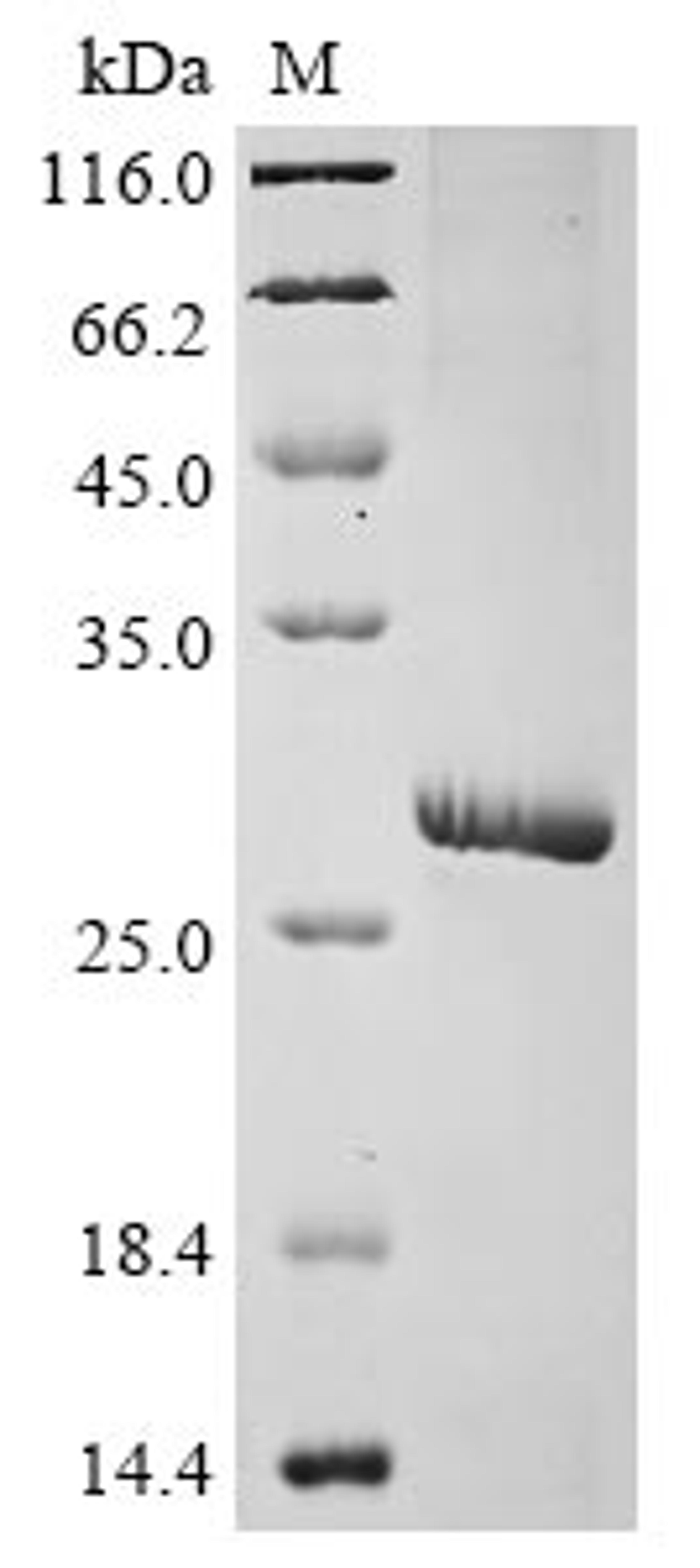(Tris-Glycine gel) Discontinuous SDS-PAGE (reduced) with 5% enrichment gel and 15% separation gel.