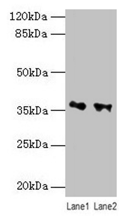 Western blot. All lanes: RDH11 antibody at 10µg/ml. Lane 1: PC-3 whole cell lysate. Lane 2: Hela whole cell lysate. Secondary. Goat polyclonal to rabbit IgG at 1/10000 dilution. Predicted band size: 36, 35, 28 kDa. Observed band size: 36 kDa