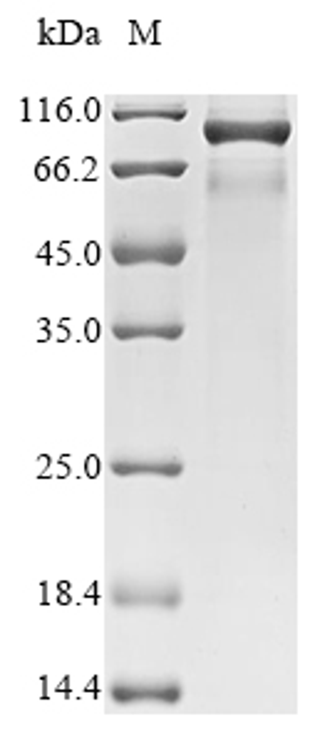 (Tris-Glycine gel) Discontinuous SDS-PAGE (reduced) with 5% enrichment gel and 15% separation gel.