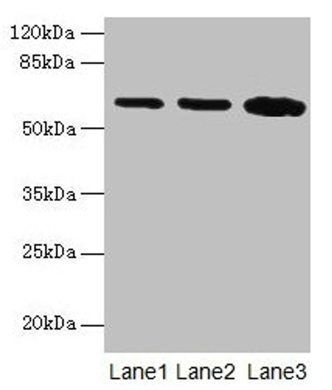 Western blot. All lanes: SPTLC2 antibody at 12µg/ml. Lane 1: HepG2 whole cell lysate. Lane 2: A549 whole cell lysate. Lane 3: HT29 whole cell lysate. Secondary. Goat polyclonal to rabbit IgG at 1/10000 dilution. Predicted band size: 63 kDa. Observed band size: 63 kDa