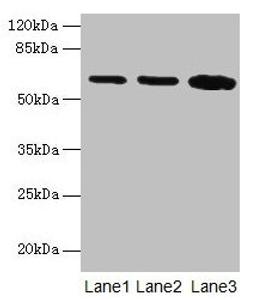 Western blot. All lanes: SPTLC2 antibody at 12µg/ml. Lane 1: HepG2 whole cell lysate. Lane 2: A549 whole cell lysate. Lane 3: HT29 whole cell lysate. Secondary. Goat polyclonal to rabbit IgG at 1/10000 dilution. Predicted band size: 63 kDa. Observed band size: 63 kDa