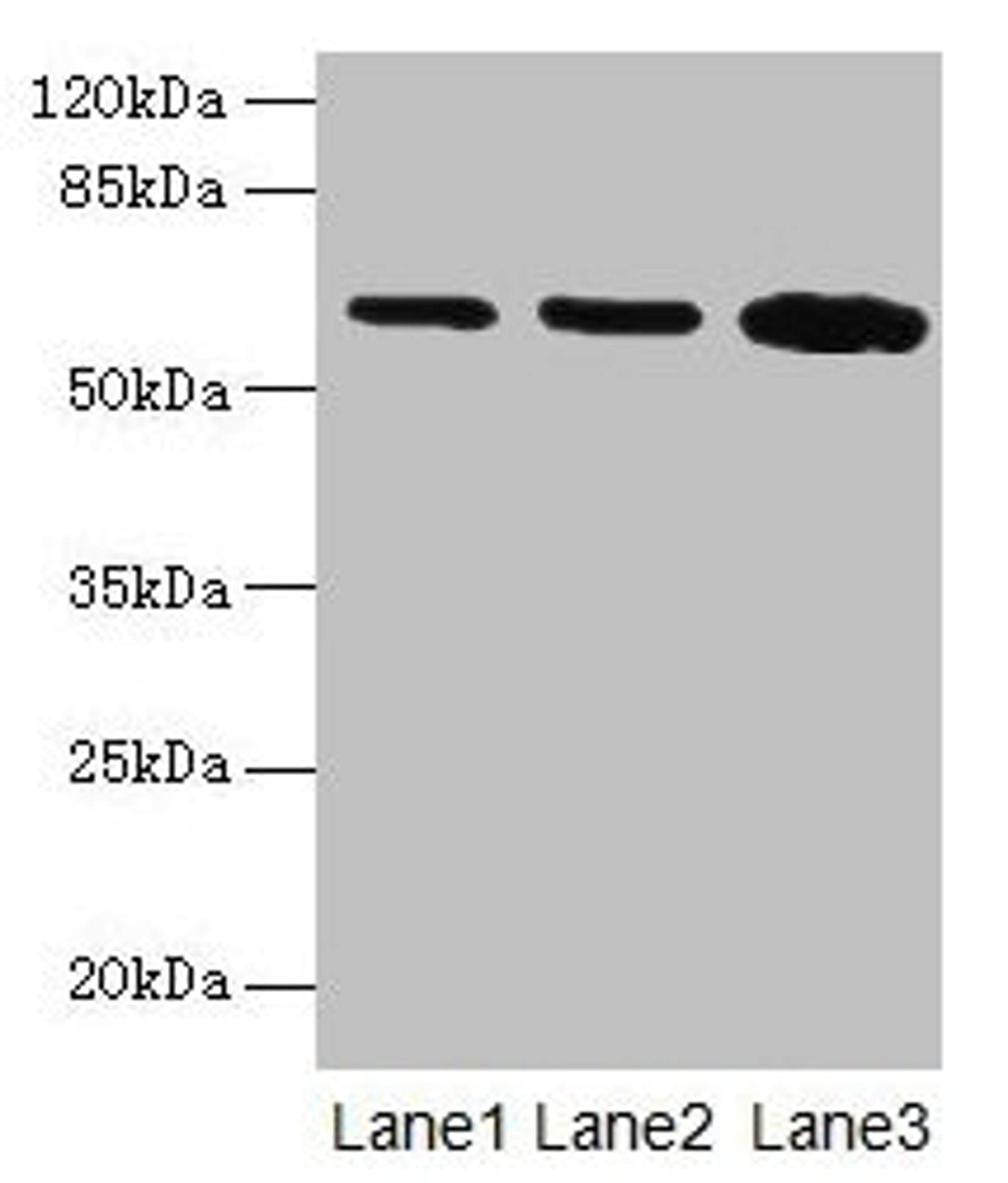 Western blot. All lanes: SPTLC2 antibody at 12µg/ml. Lane 1: HepG2 whole cell lysate. Lane 2: A549 whole cell lysate. Lane 3: HT29 whole cell lysate. Secondary. Goat polyclonal to rabbit IgG at 1/10000 dilution. Predicted band size: 63 kDa. Observed band size: 63 kDa