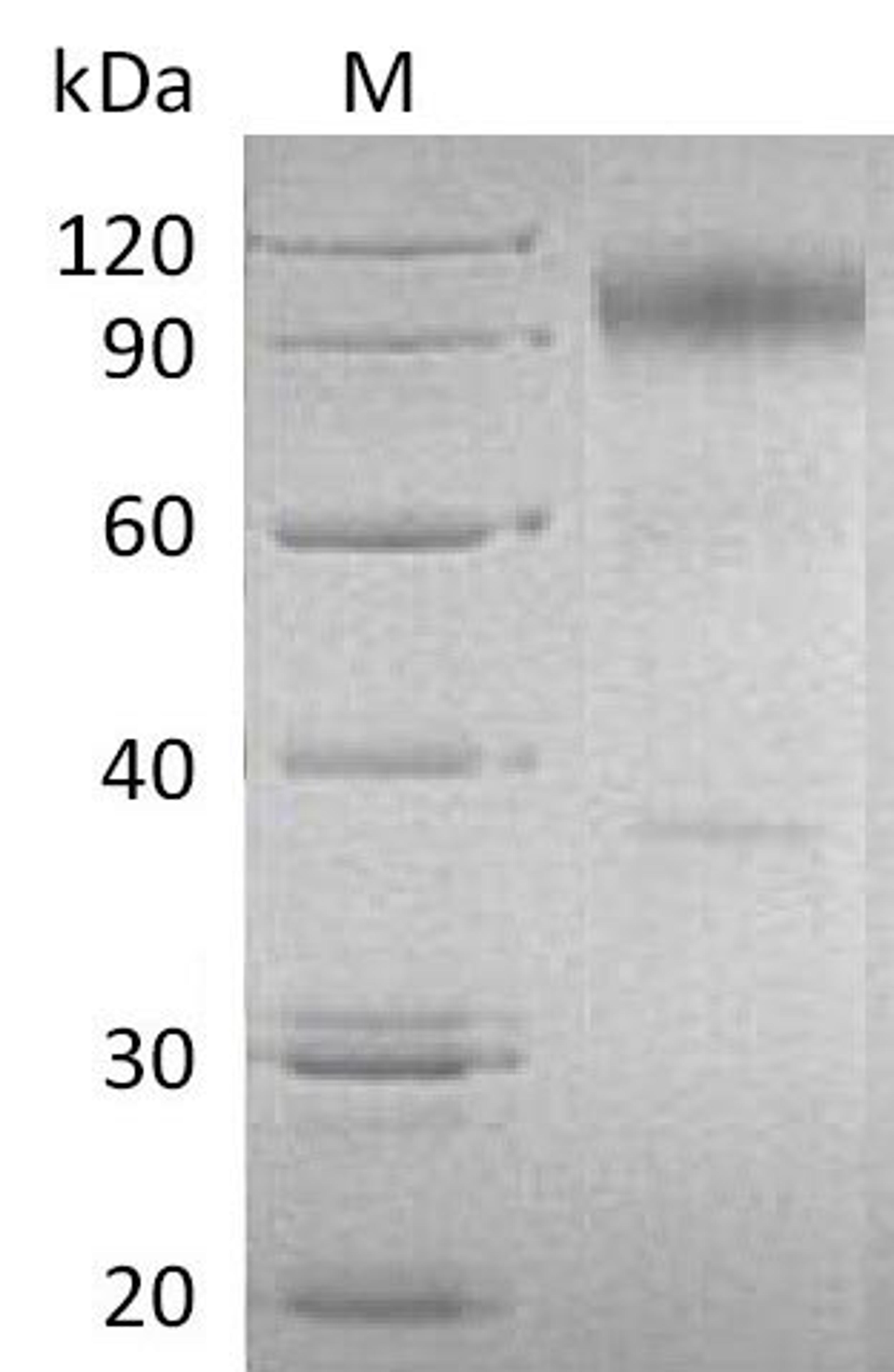 (Tris-Glycine gel) Discontinuous SDS-PAGE (reduced) with 5% enrichment gel and 15% separation gel.