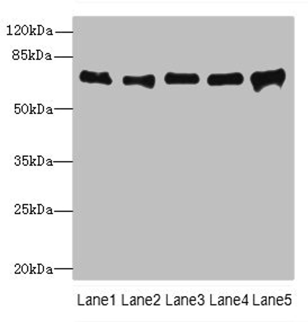 Western blot. All lanes: SPDL1 antibody at 4µg/ml. Lane 1: Hela whole cell lysate. Lane 2: 293T whole cell lysate. Lane 3: Jurkat whole cell lysate. Lane 4: A549 whole cell lysate. Lane 5: K562 whole cell lysate. Secondary. Goat polyclonal to rabbit IgG at 1/10000 dilution. Predicted band size: 71, 59, 62 kDa. Observed band size: 71 kDa