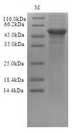(Tris-Glycine gel) Discontinuous SDS-PAGE (reduced) with 5% enrichment gel and 15% separation gel.