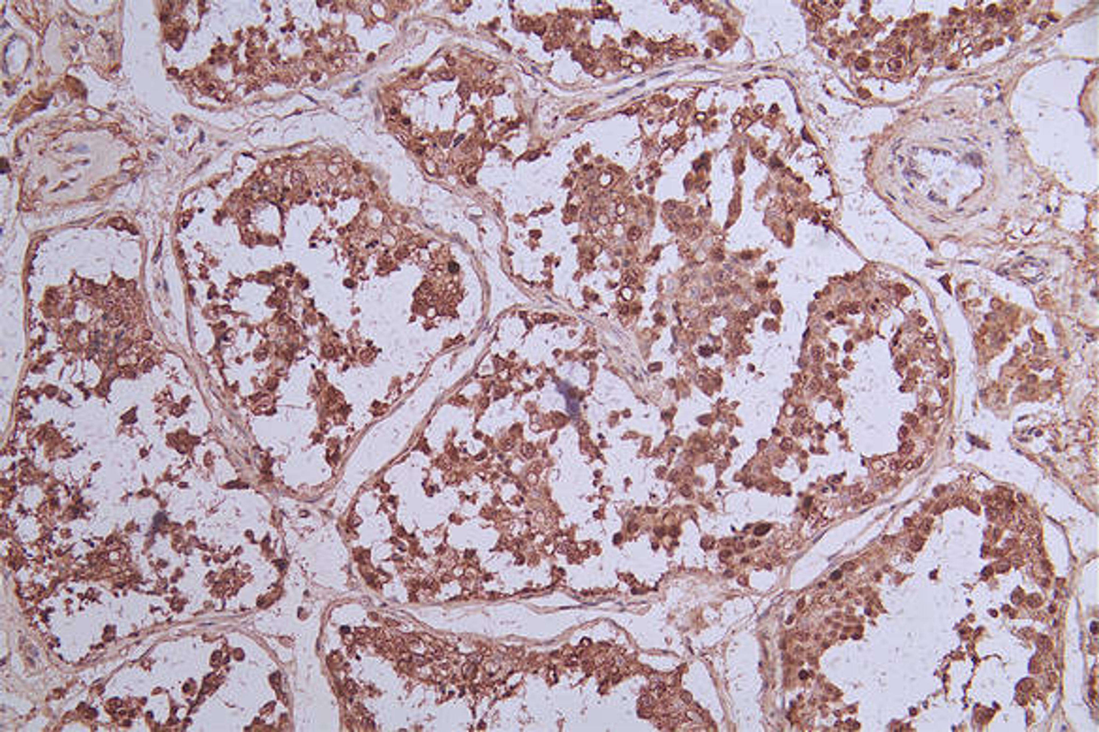 IHC image of CSB-RA131953A0HU diluted at 1:33 and staining in paraffin-embedded human testis tissue performed on a Leica BondTM system. After dewaxing and hydration, antigen retrieval was mediated by high pressure in a citrate buffer (pH 6.0). Section was blocked with 10% normal goat serum 30min at RT. Then primary antibody (1% BSA) was incubated at 4°C overnight. The primary is detected by a Goat anti-rabbit polymer IgG labeled by HRP and visualized using 0.73% DAB.