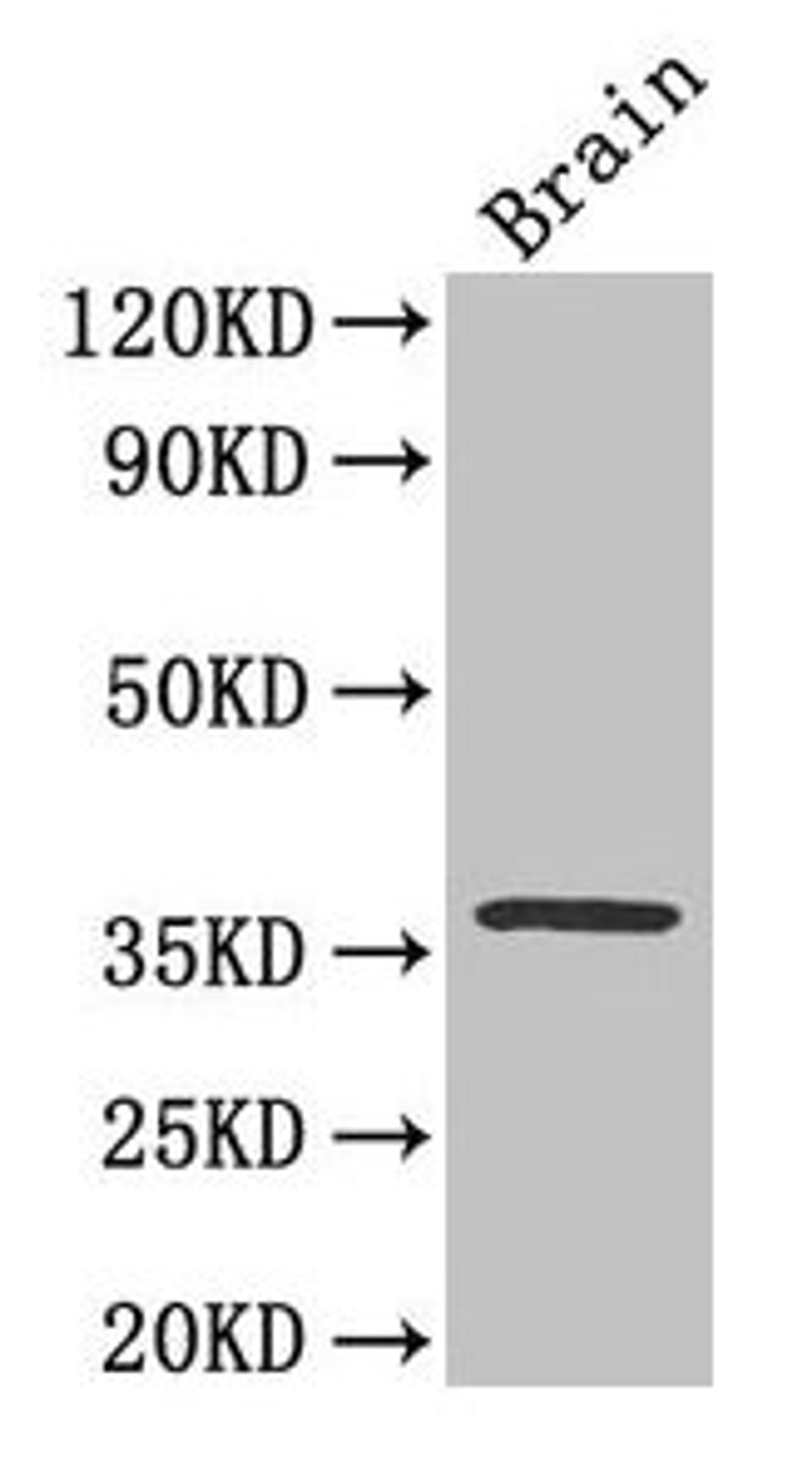 Western Blot. Positive WB detected in: Mouse brain tissue. All lanes: CREB1 antibody at 3.3µg/ml. Secondary. Goat polyclonal to rabbit IgG at 1/50000 dilution. Predicted band size: 37, 36, 26 kDa. Observed band size: 37 kDa