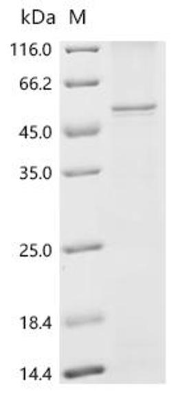 (Tris-Glycine gel) Discontinuous SDS-PAGE (reduced) with 5% enrichment gel and 15% separation gel.